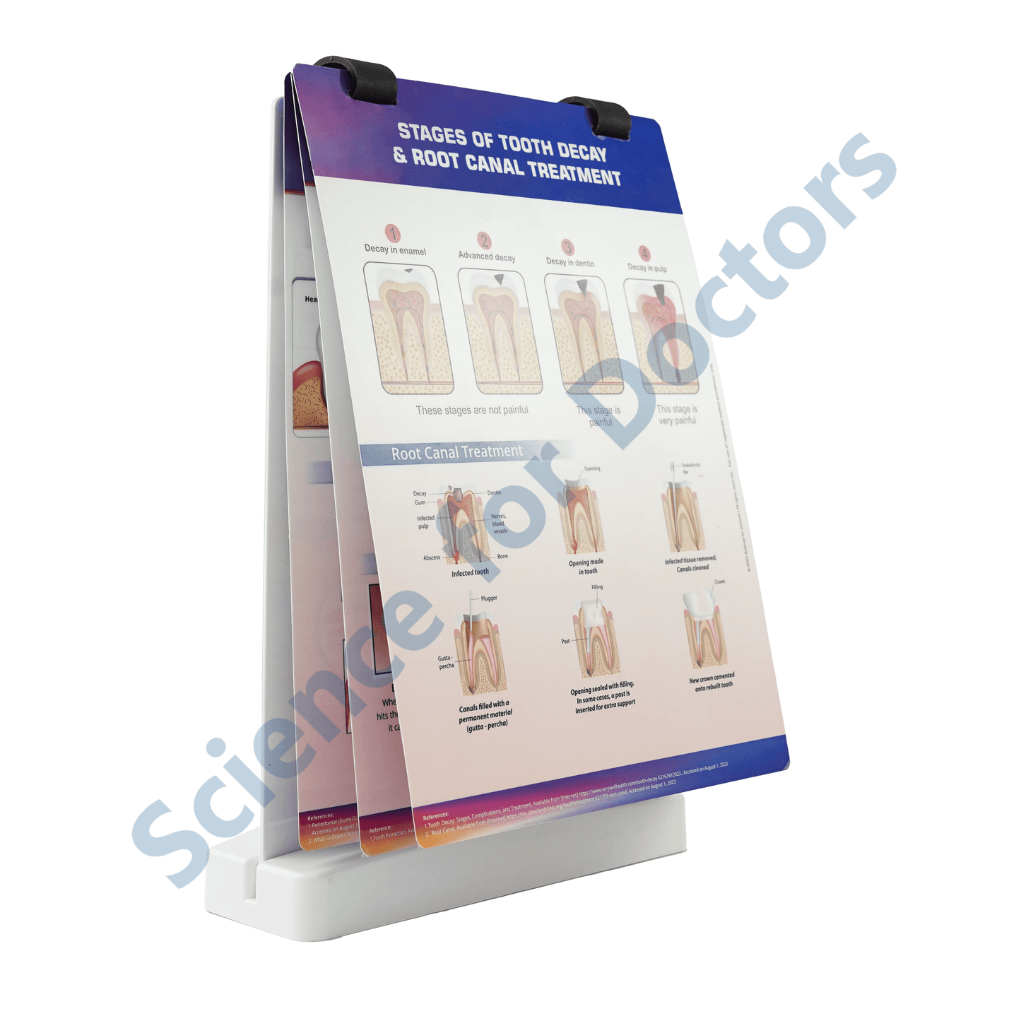 Stages of tooth decay & root canal treatment: A4 Flip Wipe