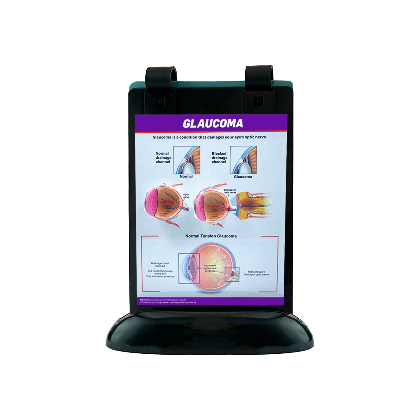 A5 Flip Wipe with 3D Therapy Board - Eye Anatomy