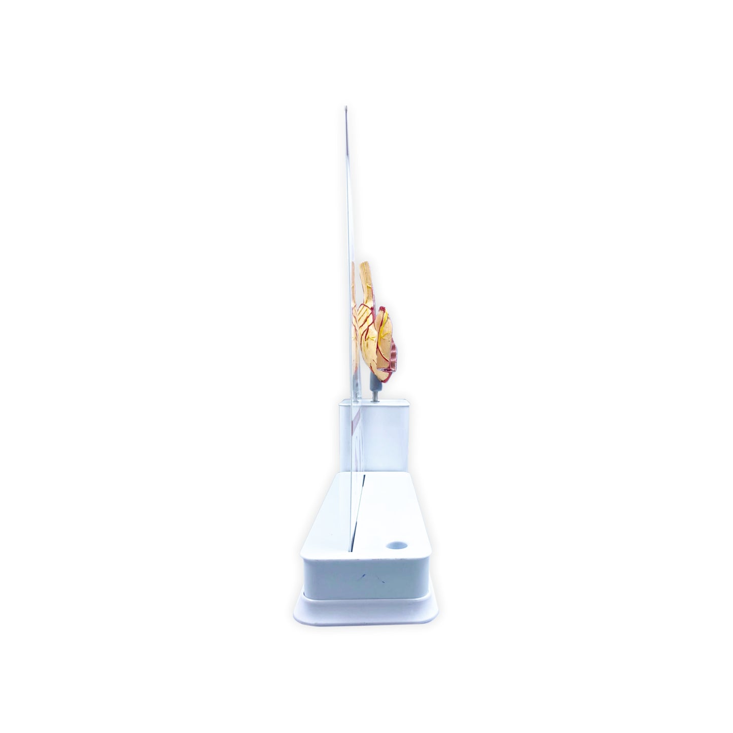 Gastroesophageal Reflux Disease_1: 1 Slide write and wipe with anatomical model on stand