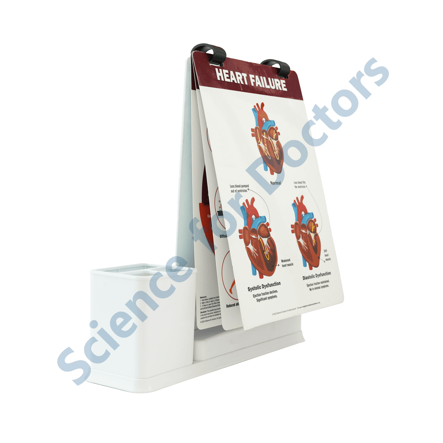 Heart Failure: A4 Flip Wipe With Stationary Stand