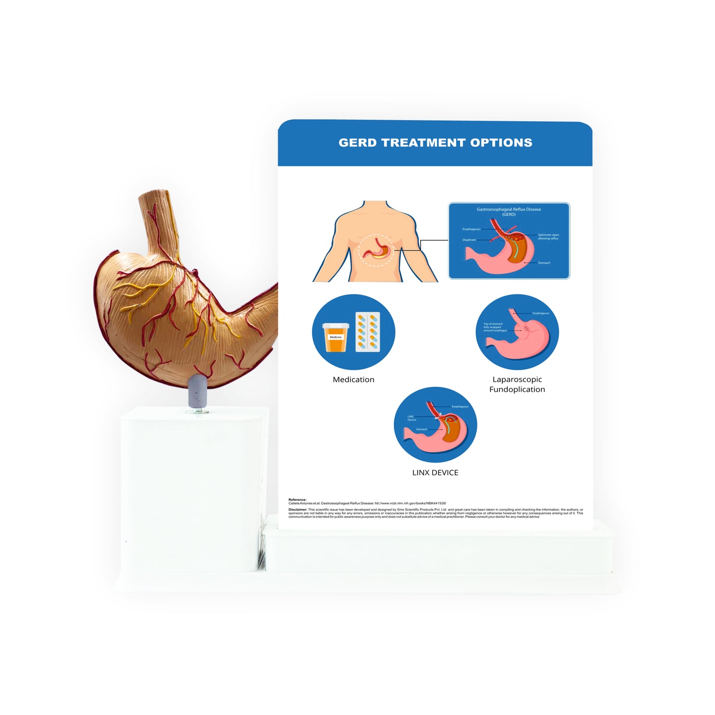 Gastroesophageal Reflux Disease: 1 Slide write and wipe with anatomical model on stand