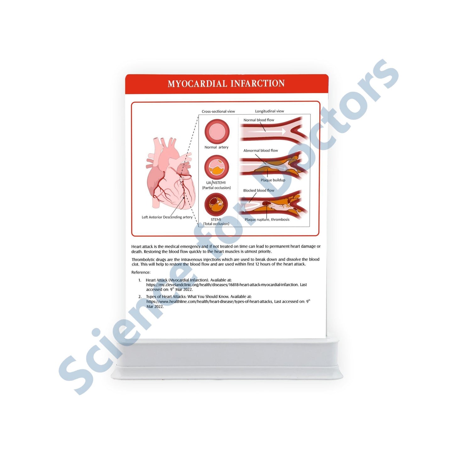 Myocardial Infarction_2: One slide with Tray
