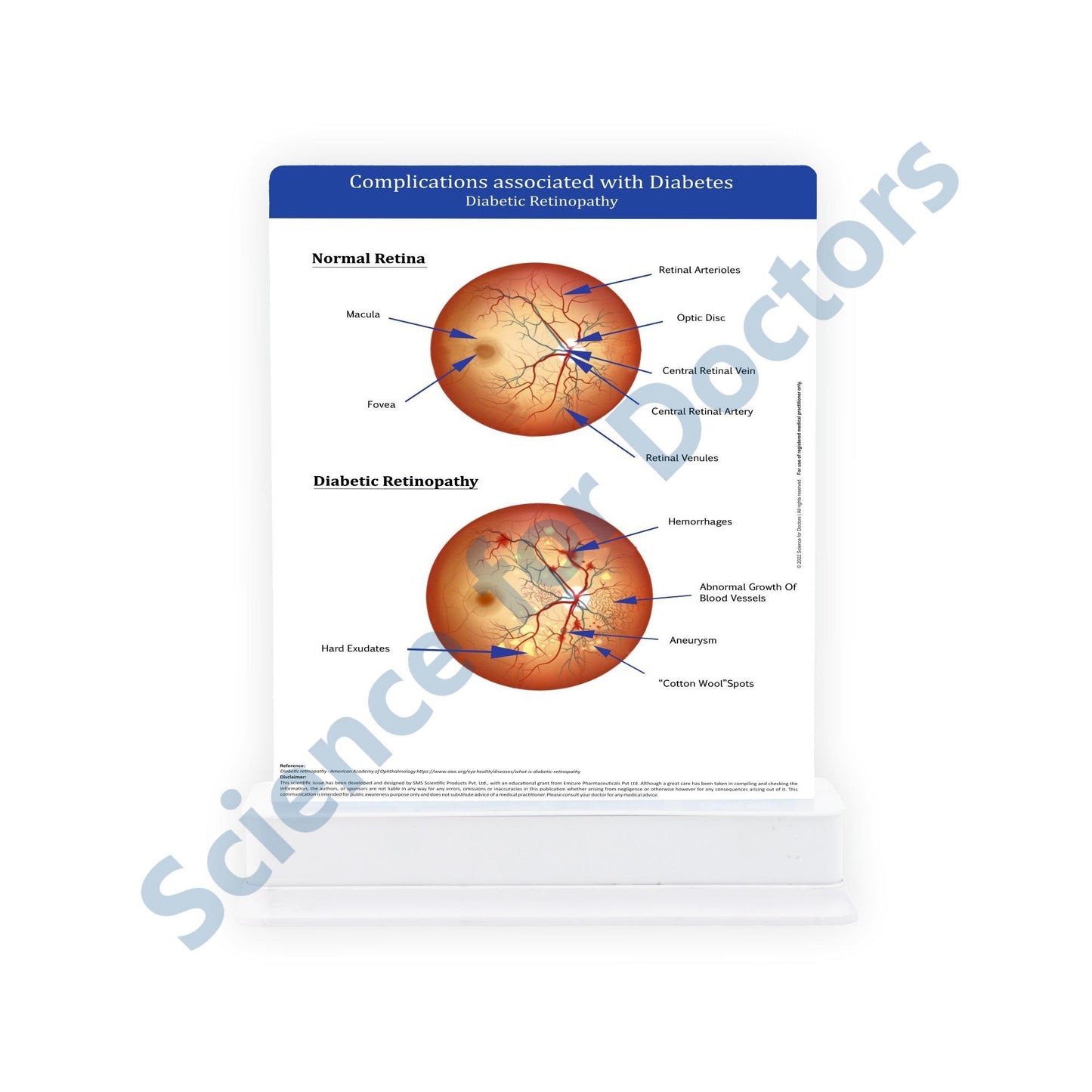 Complications of Diabetes: 3 Slides on Stand