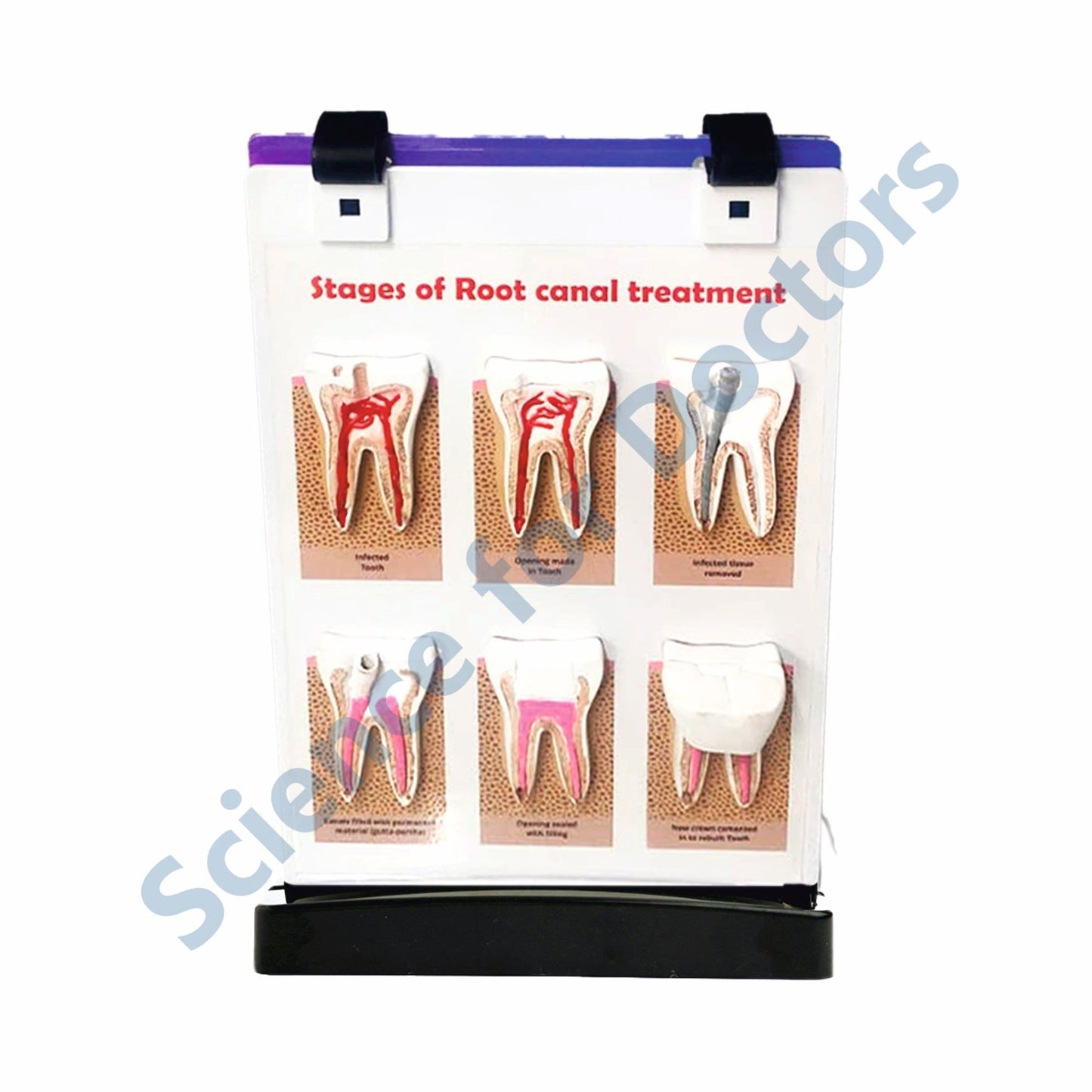 Teeth Anatomy: A4 Flip Wipe with 3D Therapy Board