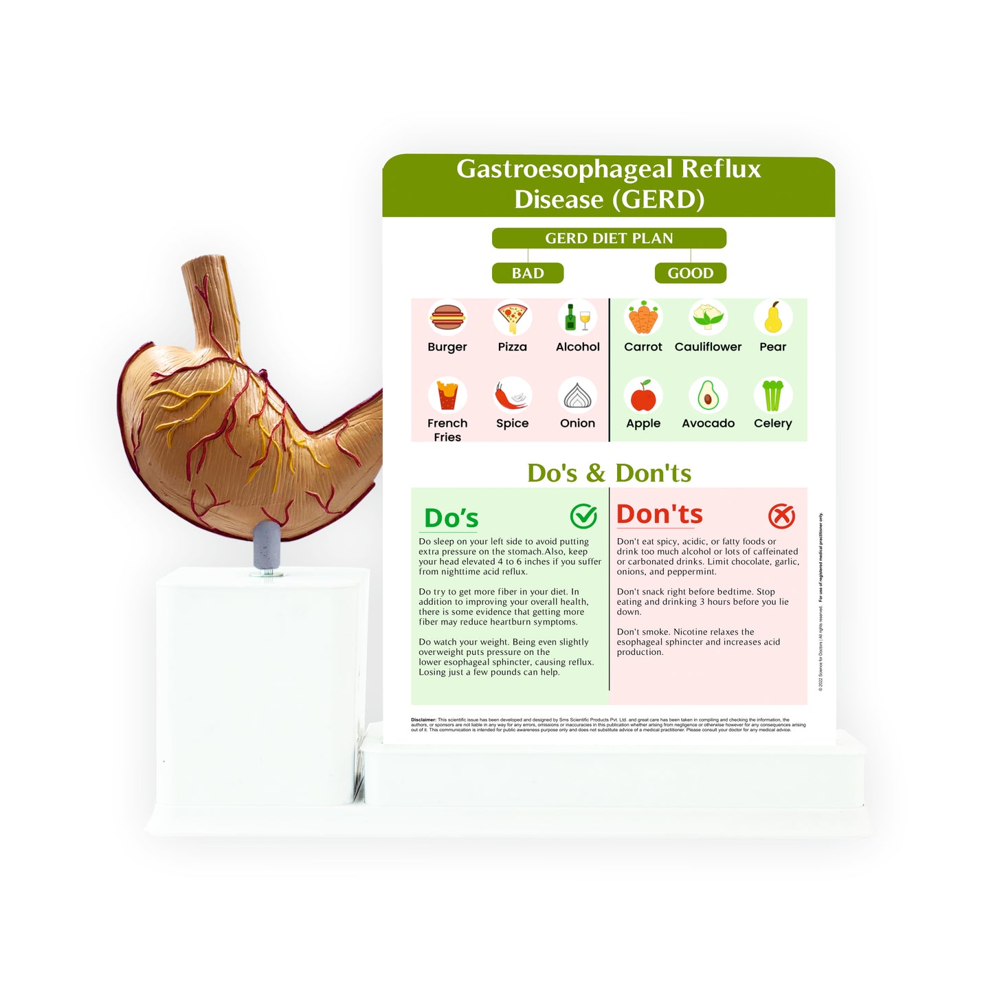 Gastroesophageal Reflux Disease_1: 1 Slide write and wipe with anatomical model on stand