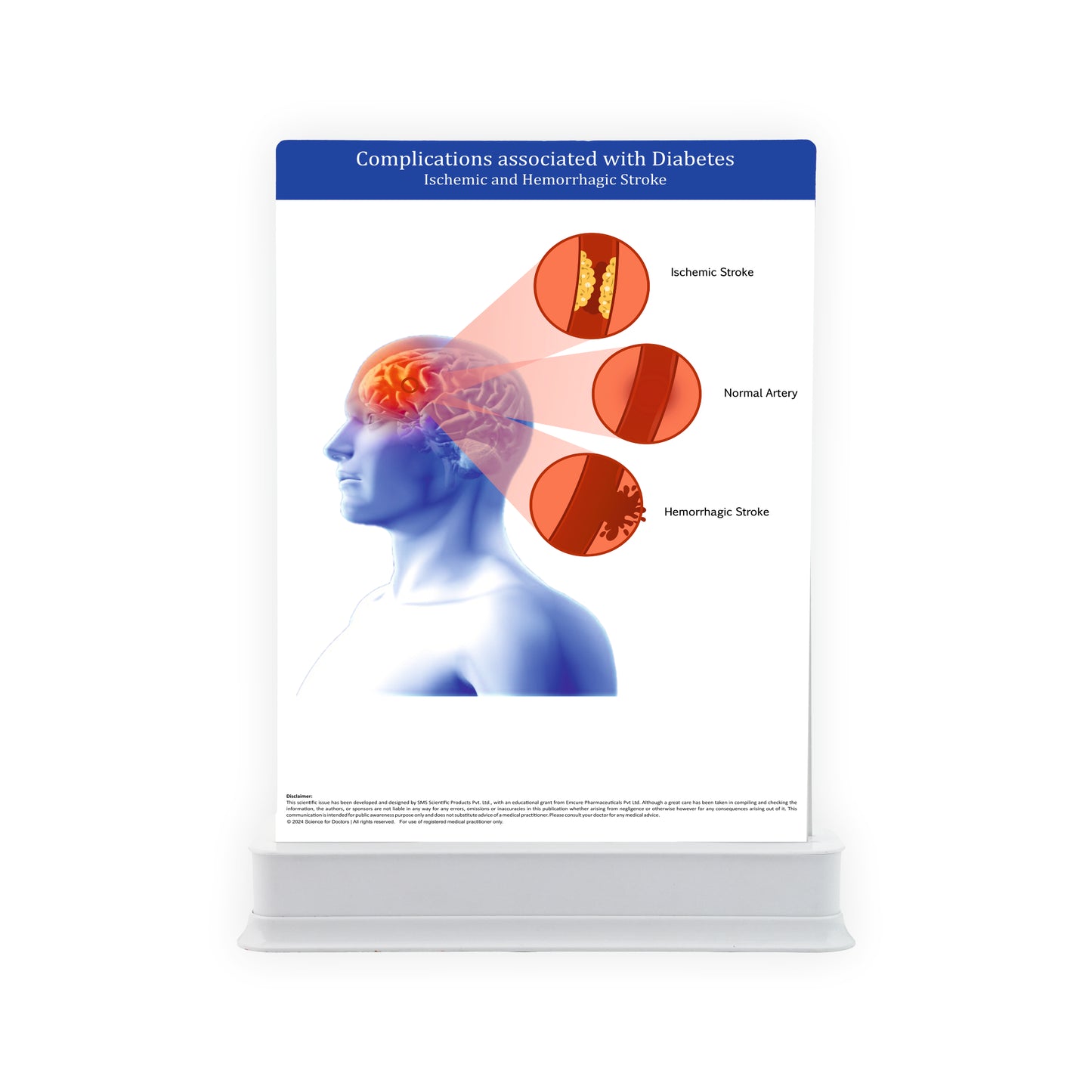 Complicated Associated With Diabetes: 2 Slides Patient Leaflet Tray