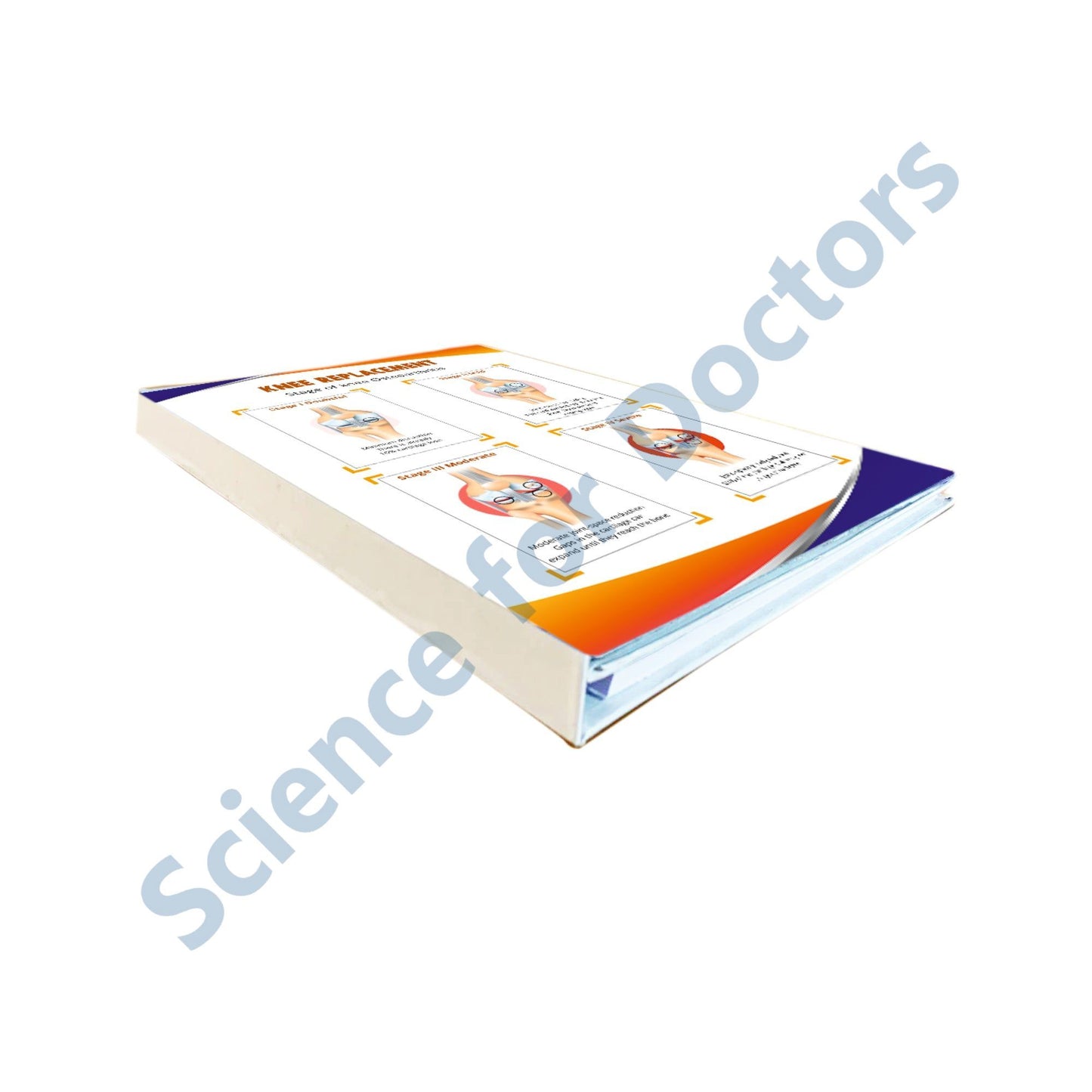 Three Fold Book Write & Wipe :Knee Replacement