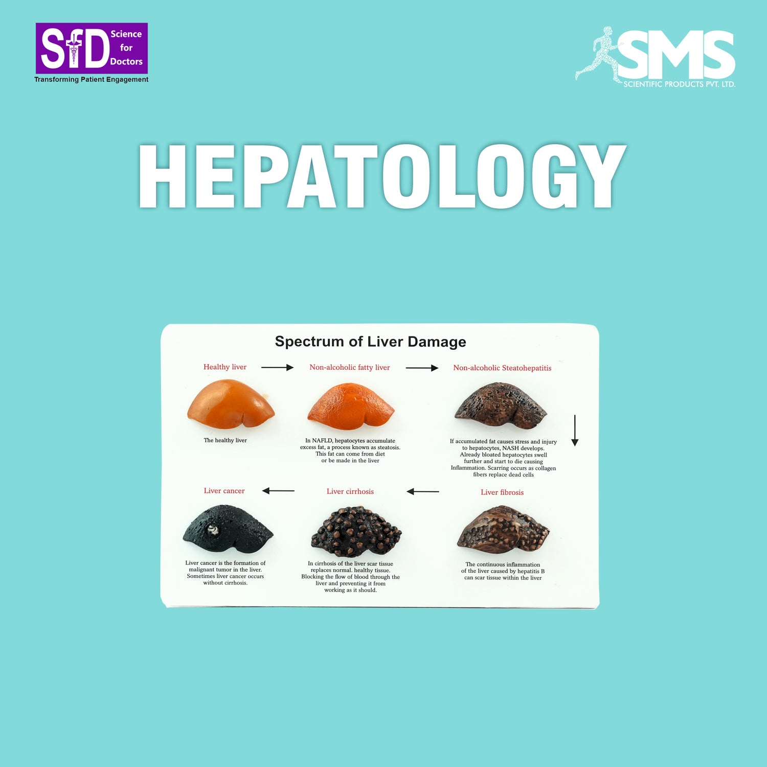 HEPATOLOGY