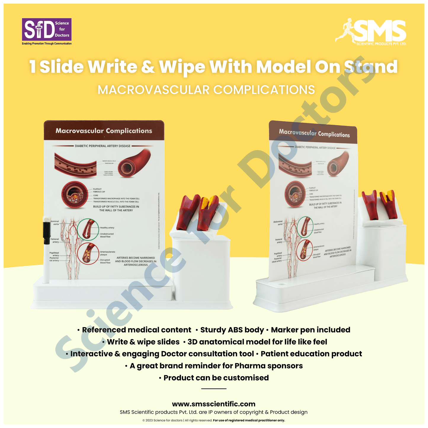 Macrovascular Complications Diabetic Peripheral Artery Disease : 1 Slide write and wipe with anatomical model on stand