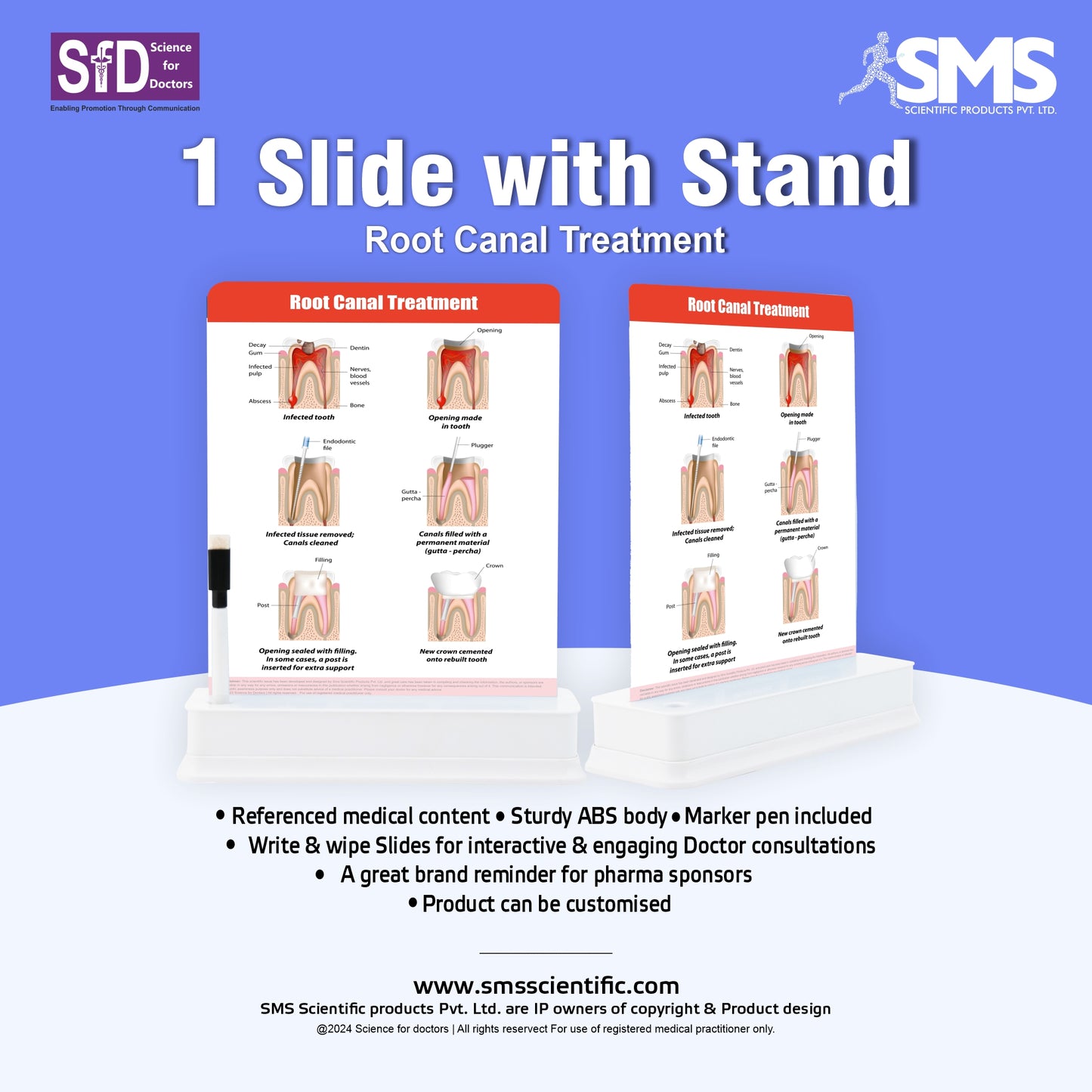 Root Canal Treatment: 1 Slide on stand