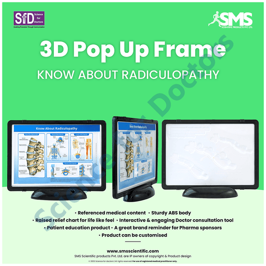 Know about Radiculopathy: 3D Pop Up Frame* (MOQ 300)