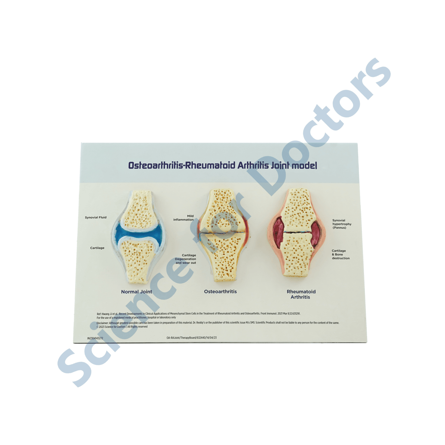 Osteoarthritis: 3d therapy Board