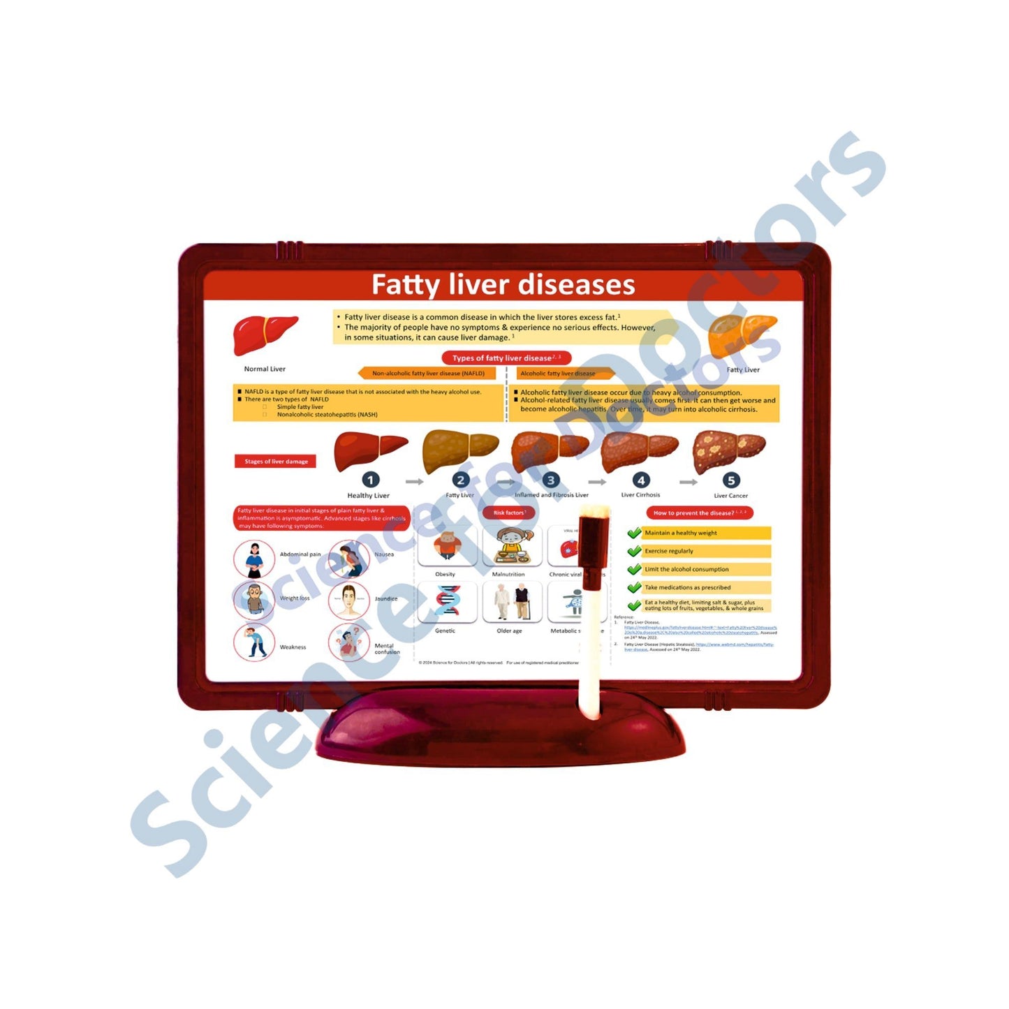 Fatty Liver diseases: The Frame Write & Wipe