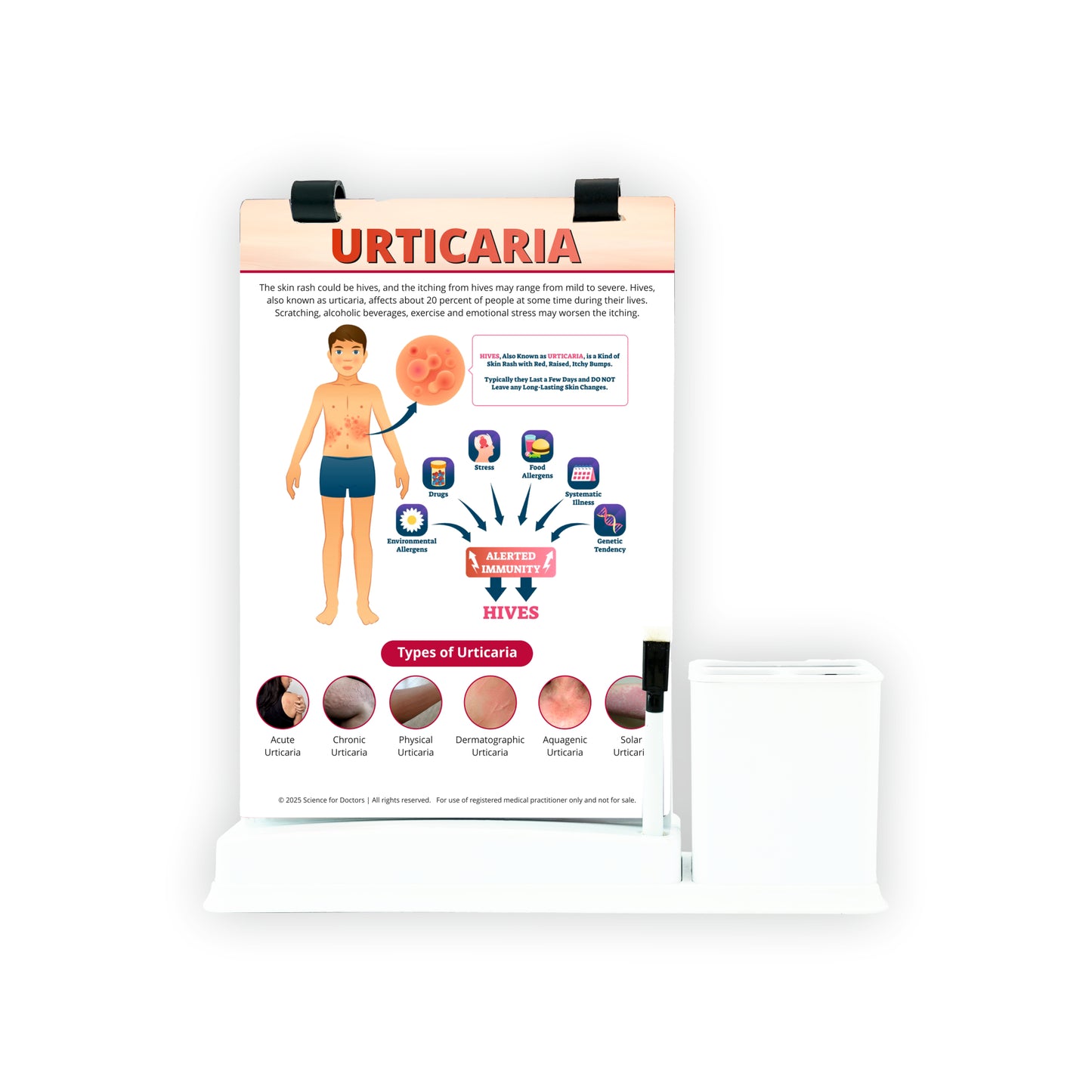 Urticaria: A4 Flip Wipe With Stationery Stand