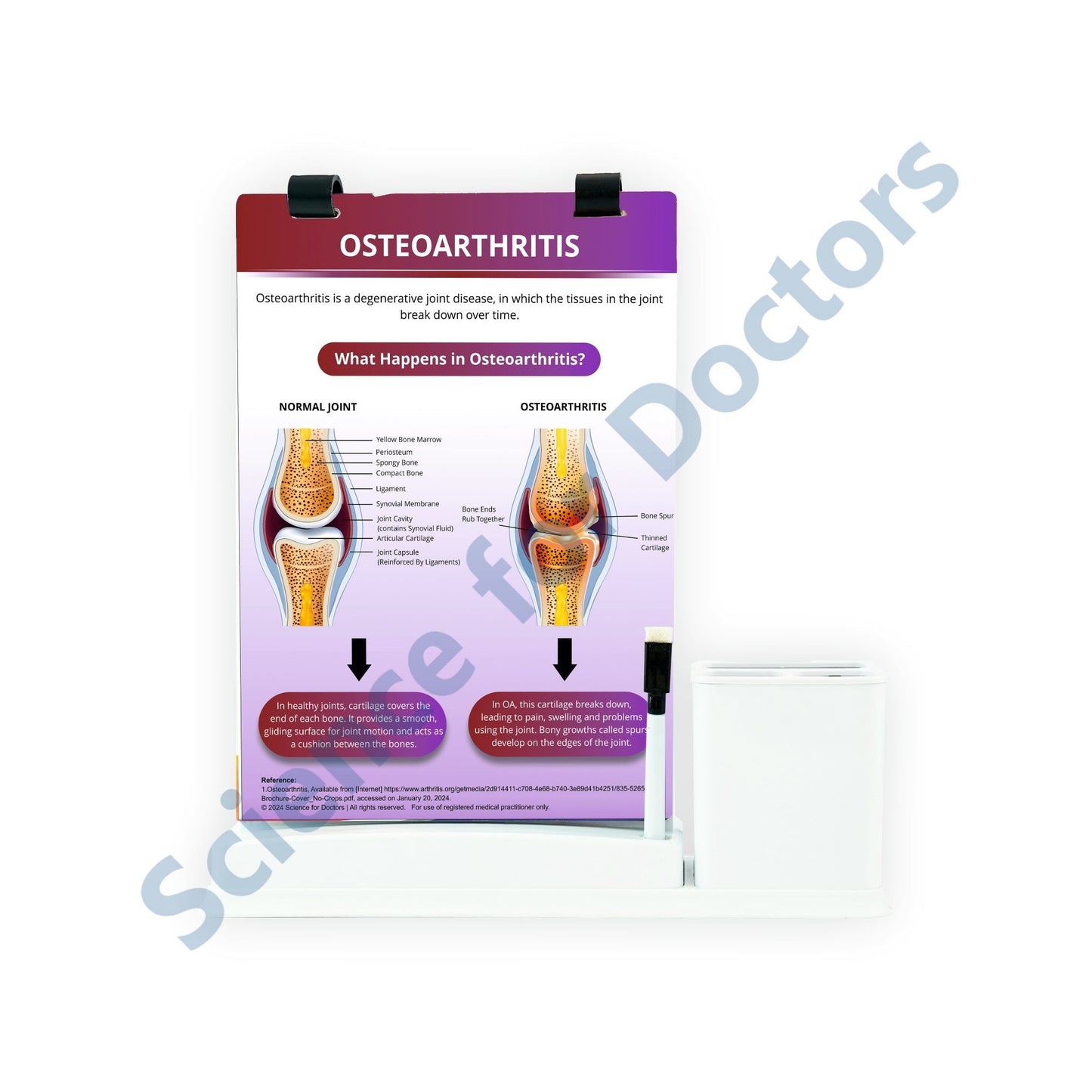 Osteoarthritis: A4 Flip Wipe With Stationary Stand