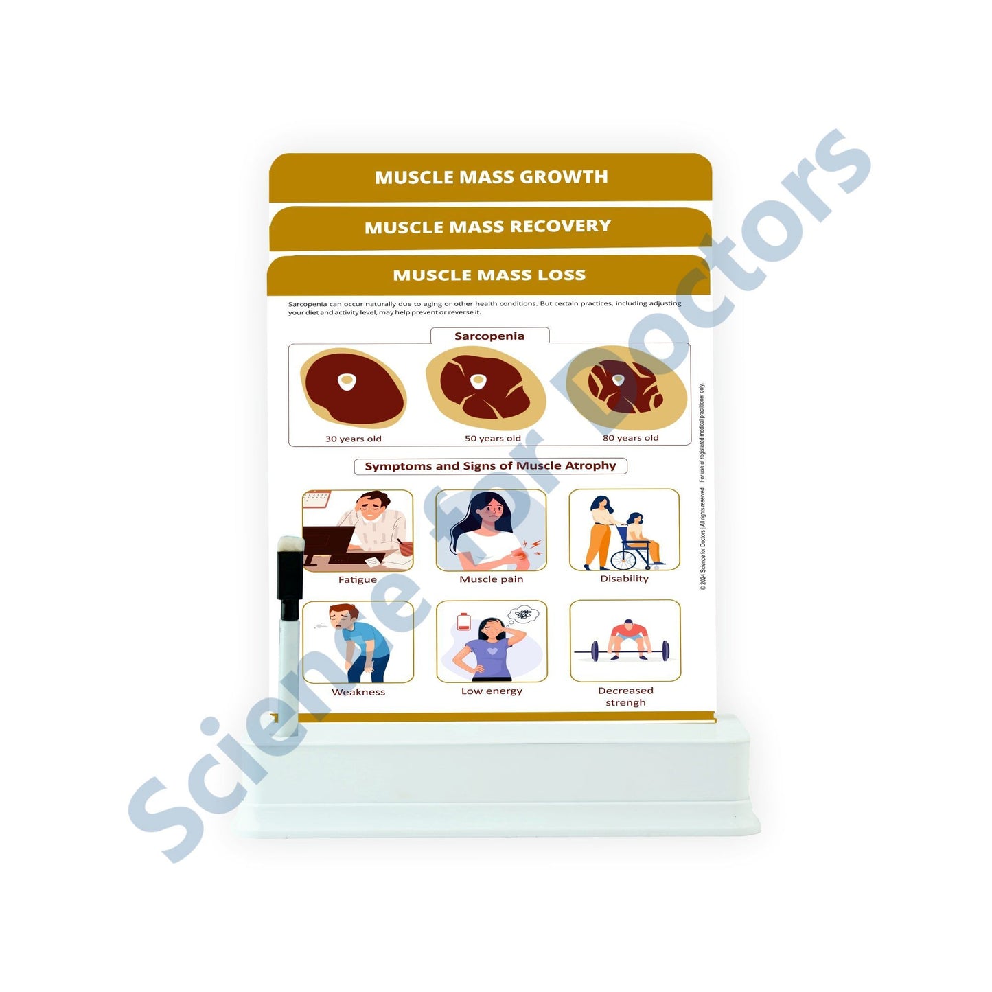 Muscle Mass Loss: 3 Slides on stand