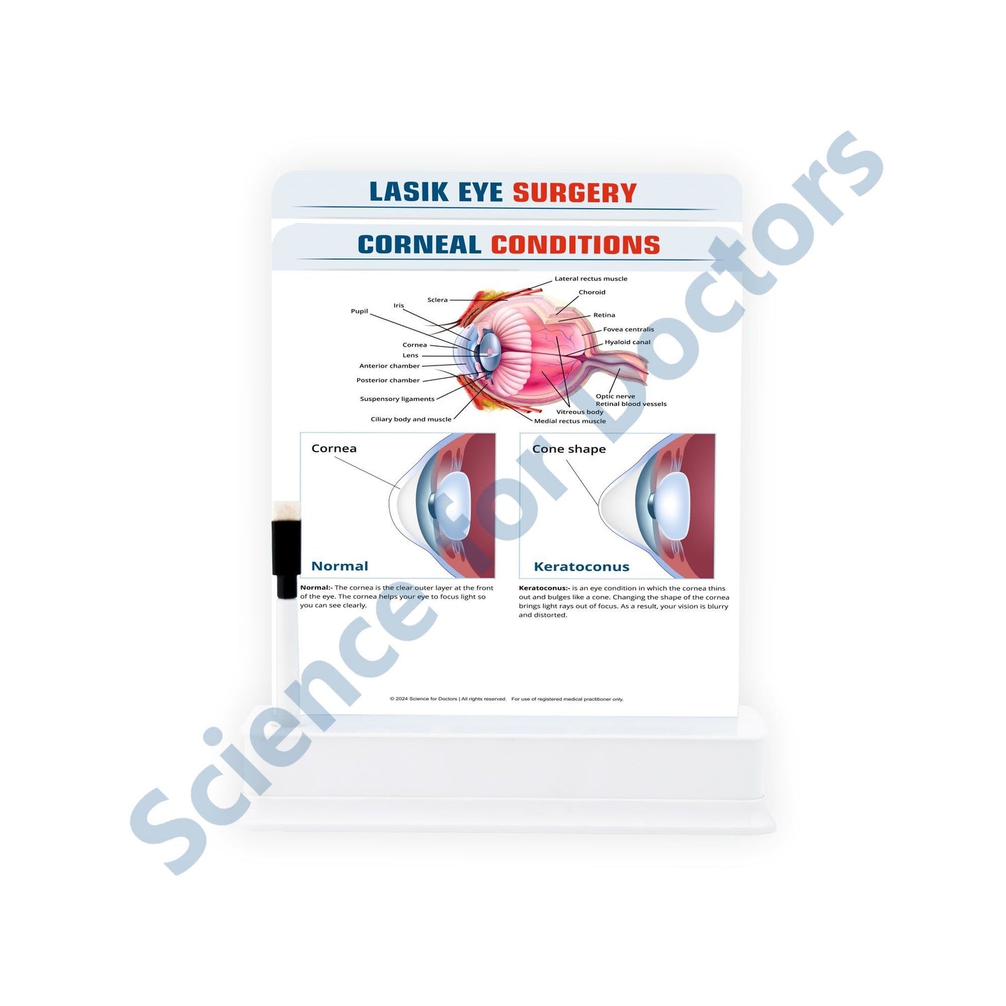 Corneal Conditions - 2 Slide With Stand