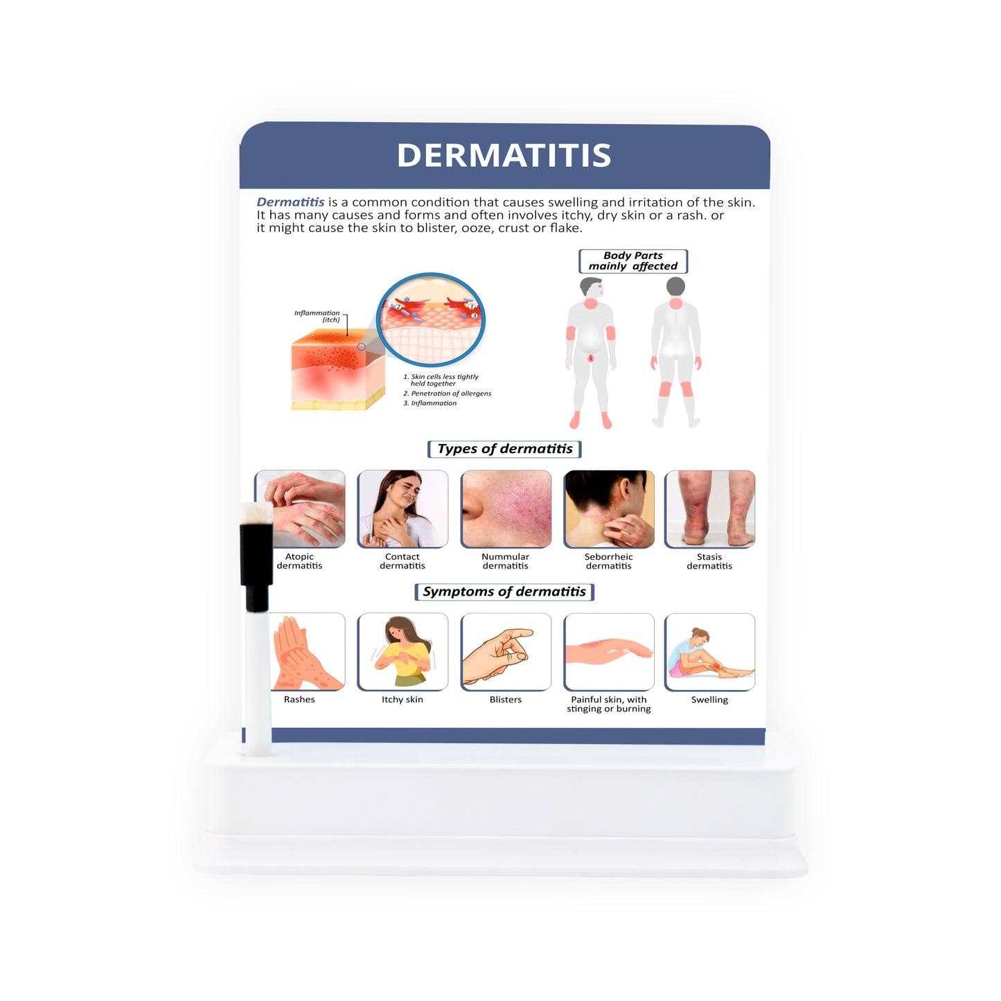 Dermatitis: 1 Slide On Stand