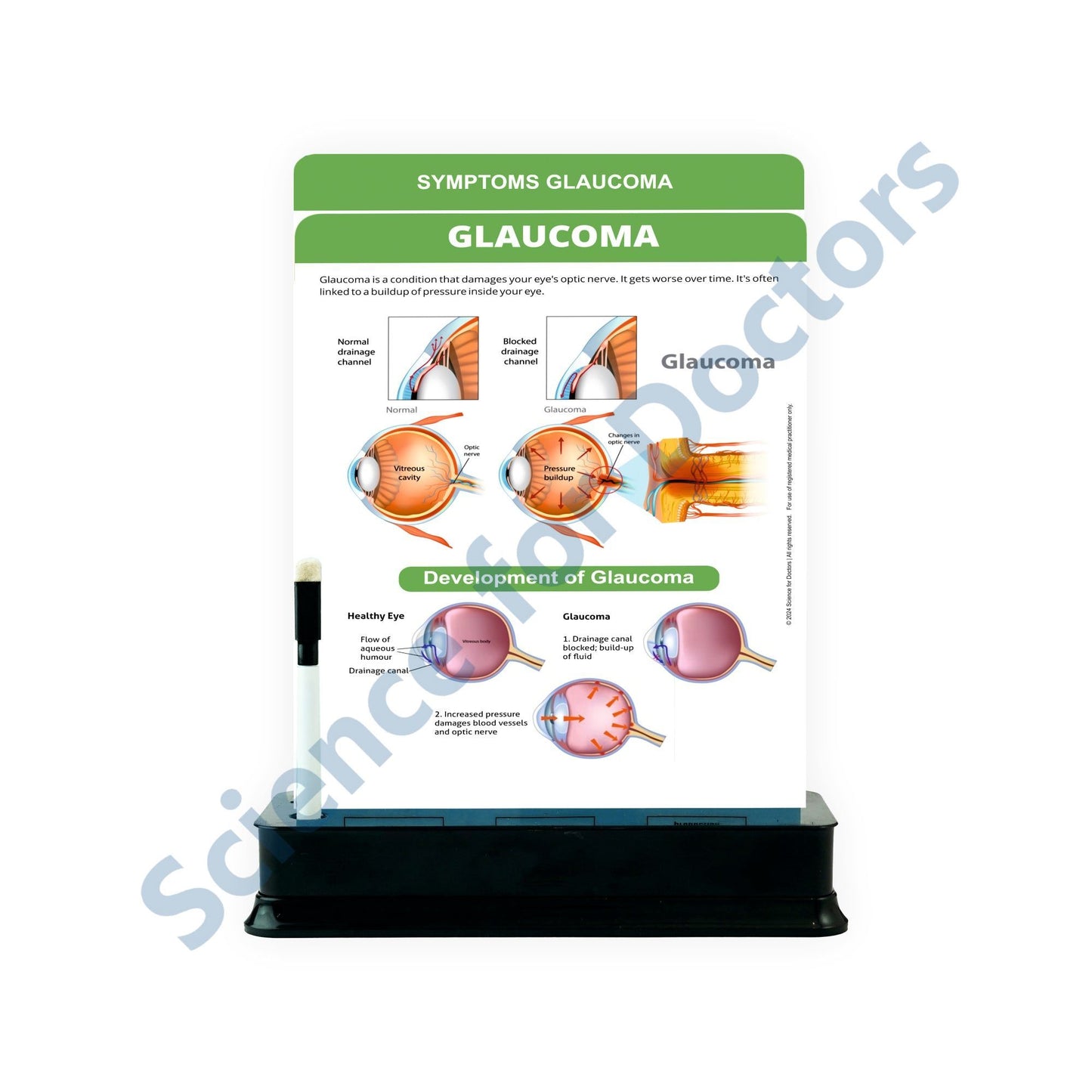 Glaucoma - 2 Slides With Stand