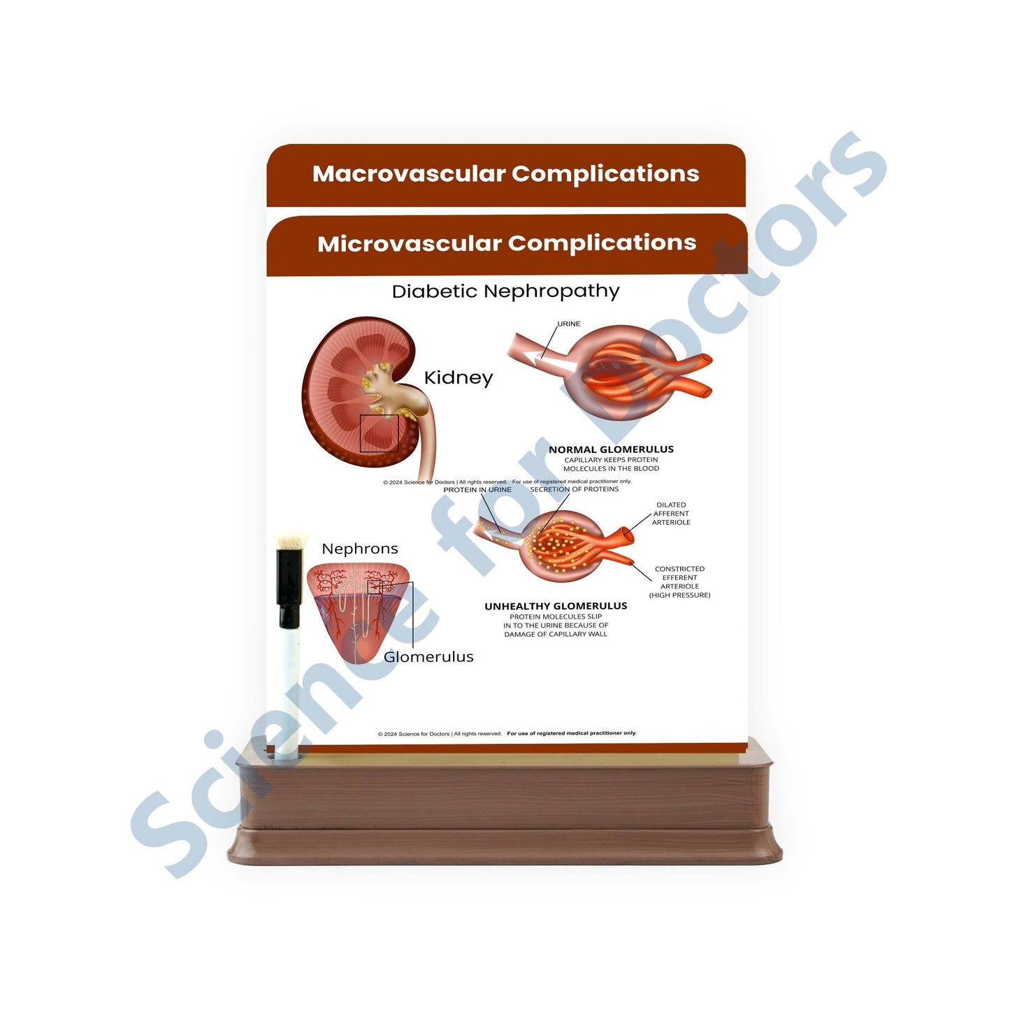 Microvascular Complications: 2 Slides on stand