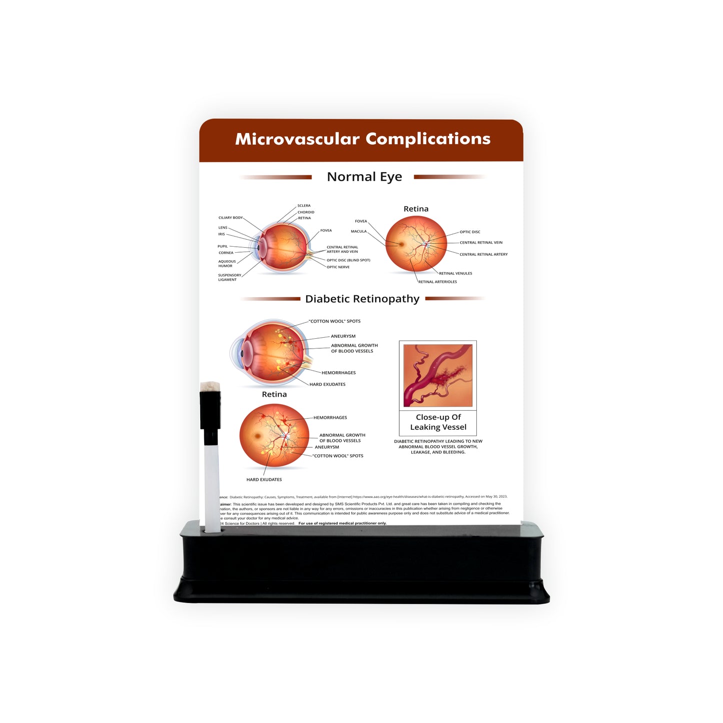 Microvascular Complications_1: 1 Slide on stand