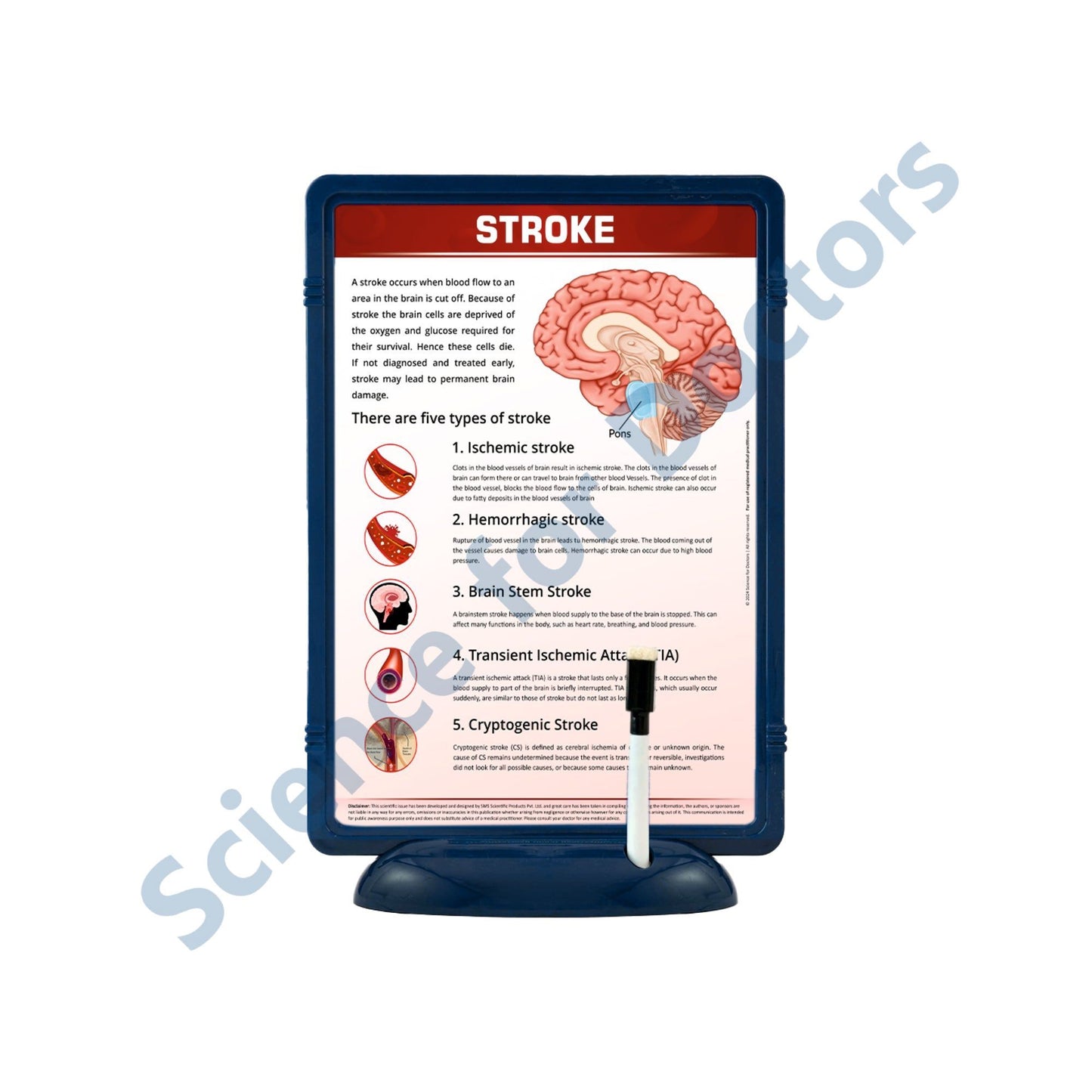 Stroke: The Frame Write & Wipe