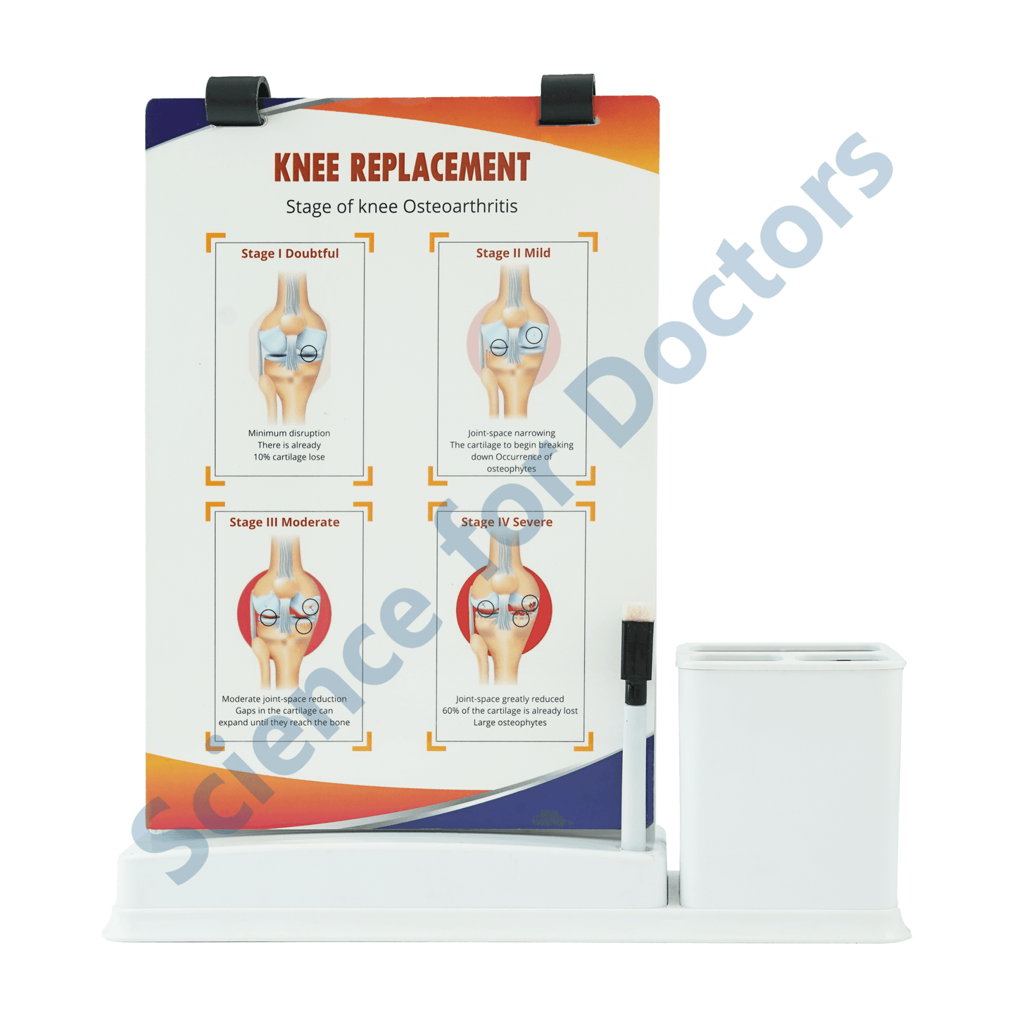 Knee Replacement: A4 Flip Wipe With Stationary Stand