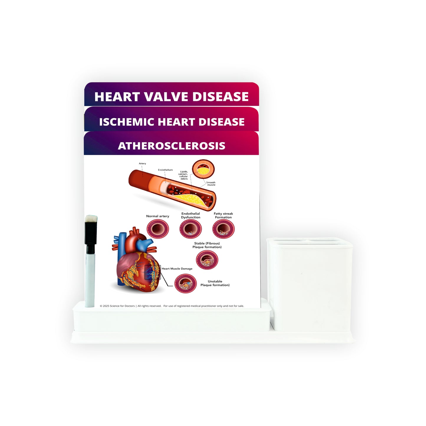 Plaque Rupture and Thrombosis: 3 Slides Write & Wipe with Stationary Stand