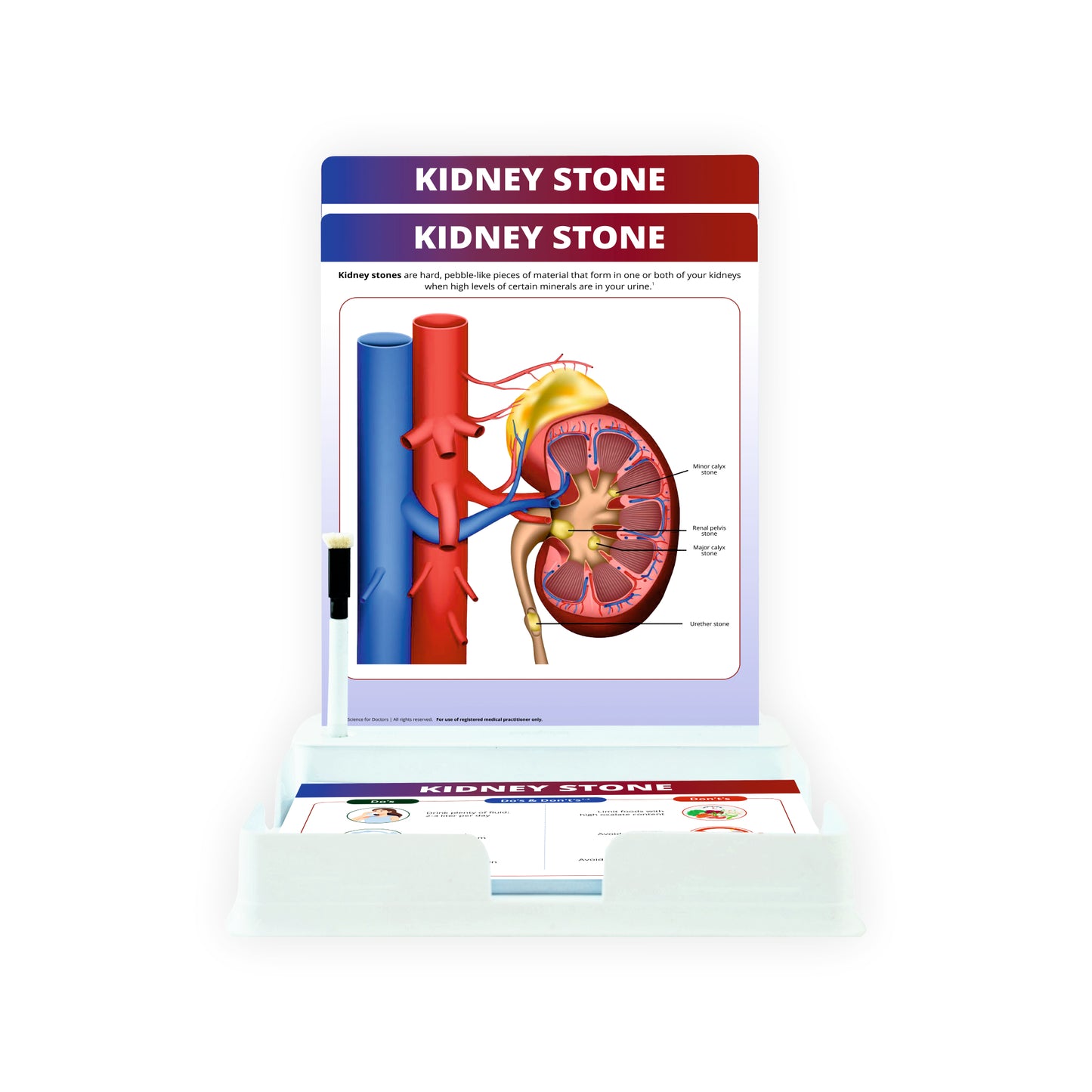 Kidney Stone : 2 Slides Patient Leaflet Tray