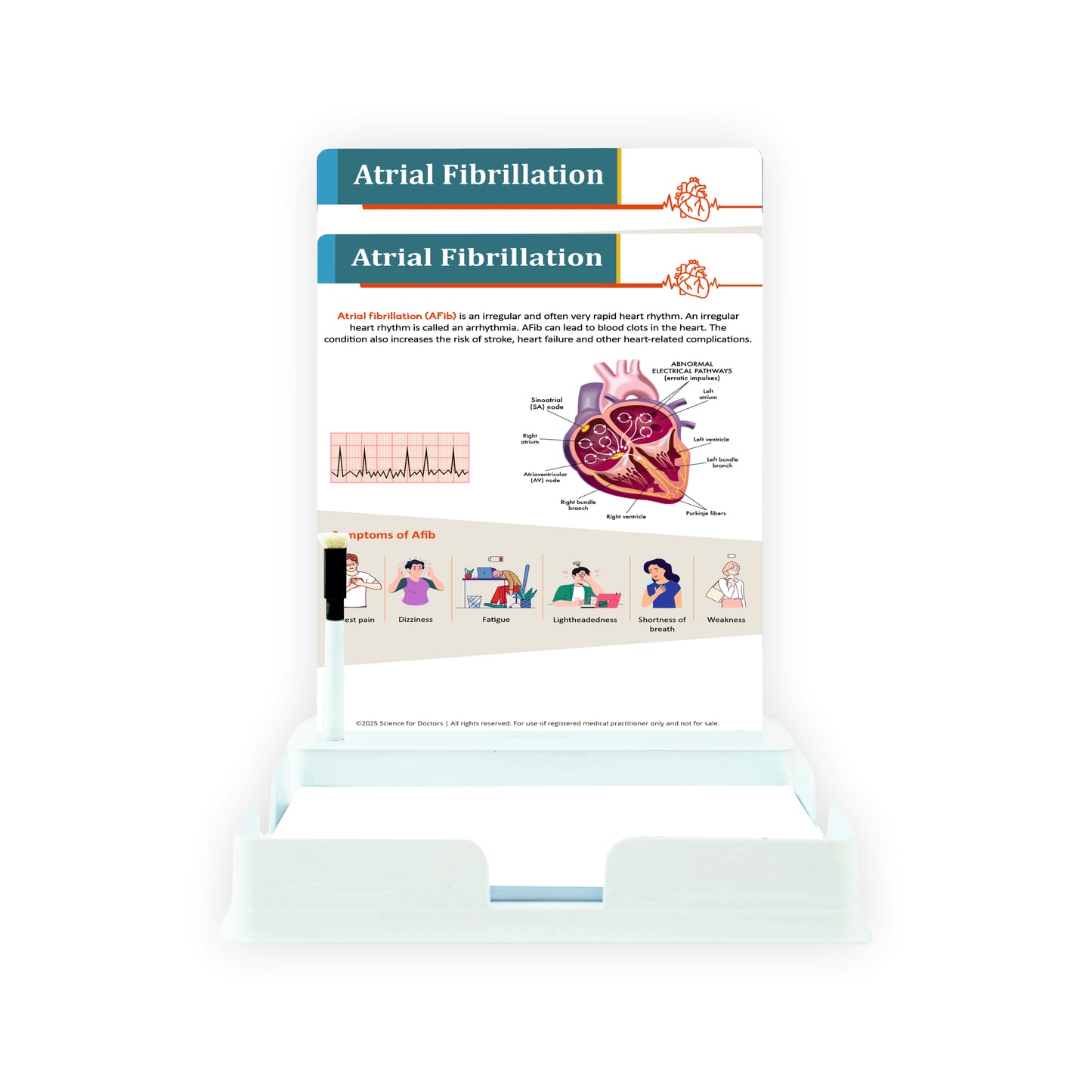 Atrial Fibrillation: 2 Slides With Tray