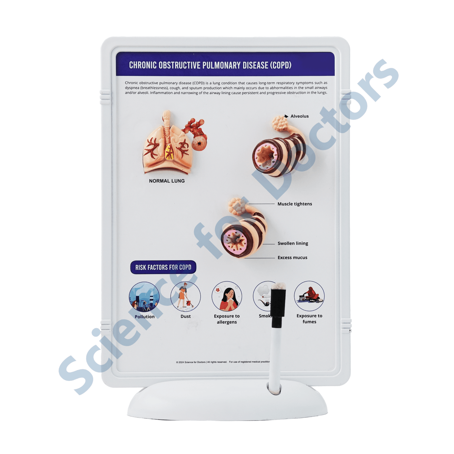 COPD(Chronic Obstructive Pulmonary Disease): 3D Therapy Frame