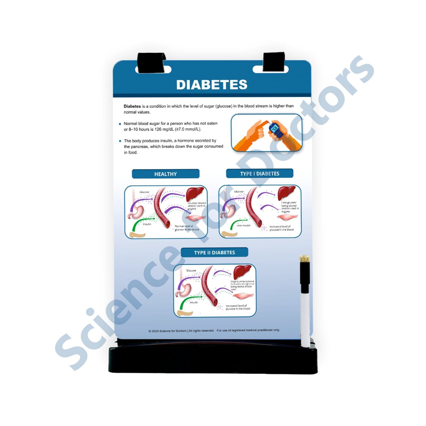 Diabetes -1: A4 Flip Wipe