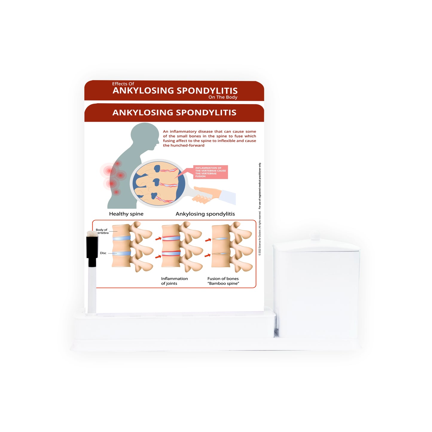 2 Slides Write & Wipe with Utility Container  - Ankylosing Spondylitis