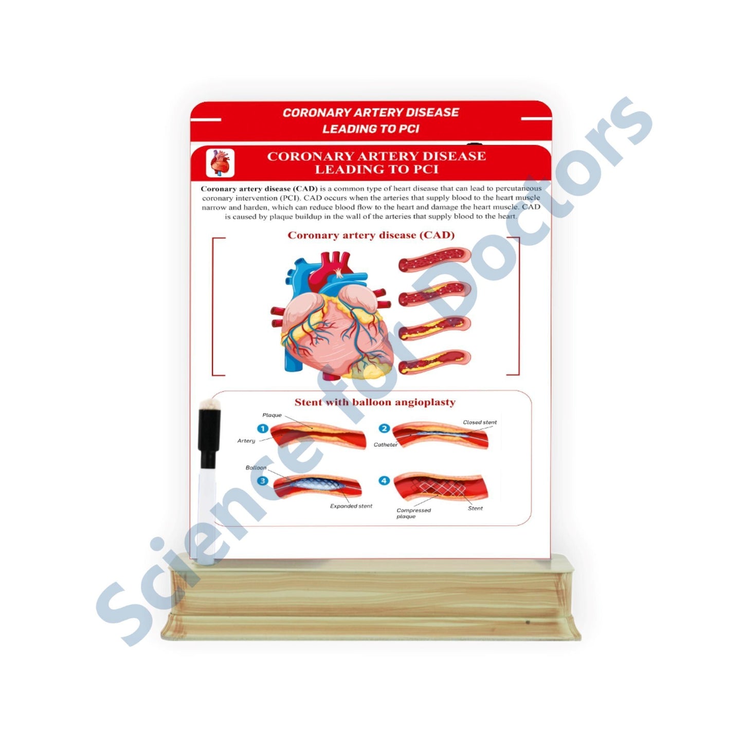 Coronary Artery Disease Leading to PCI: 2 Slide on stand