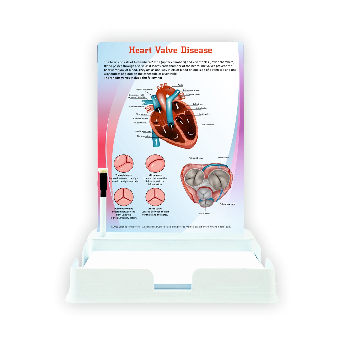 Heart Valve Disease: 1 Slides With Tray