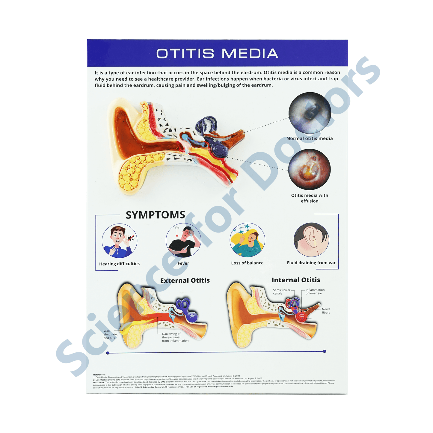 Otitis Media: 3d therapy Board