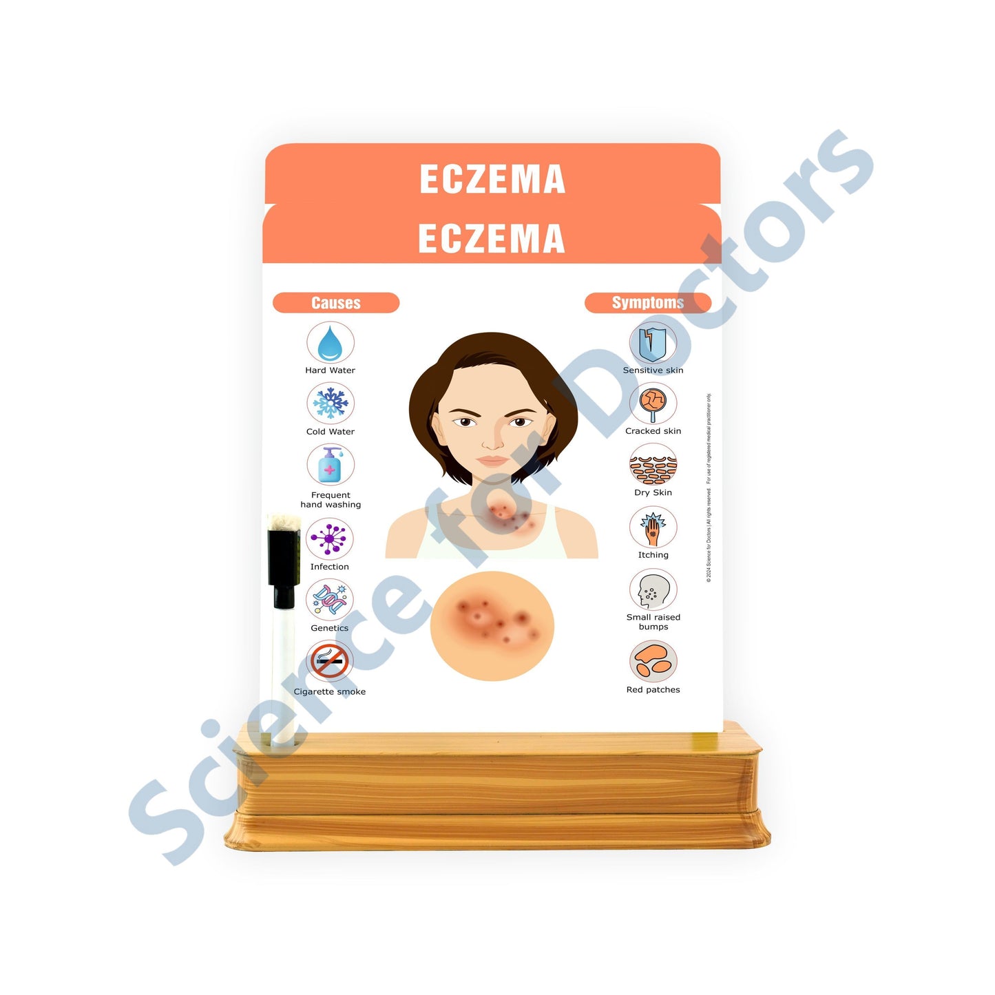 Eczema: 2 Slides on stand