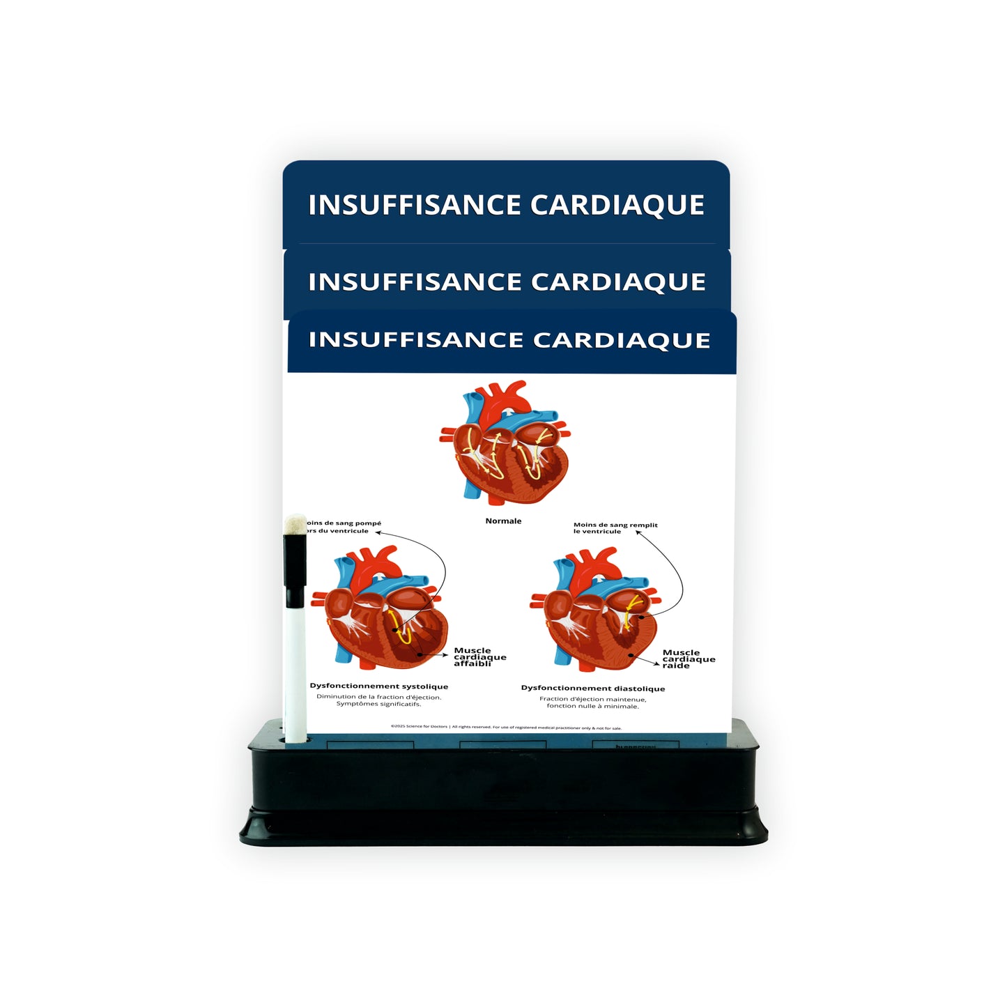 Insuffisance Cardiaque: 3 Slides on Stand