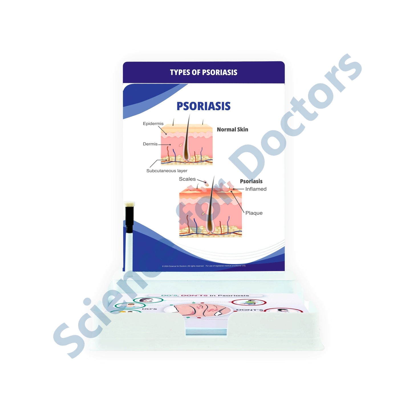 Psoriasis: 2 Slides Patient Leaflet Tray