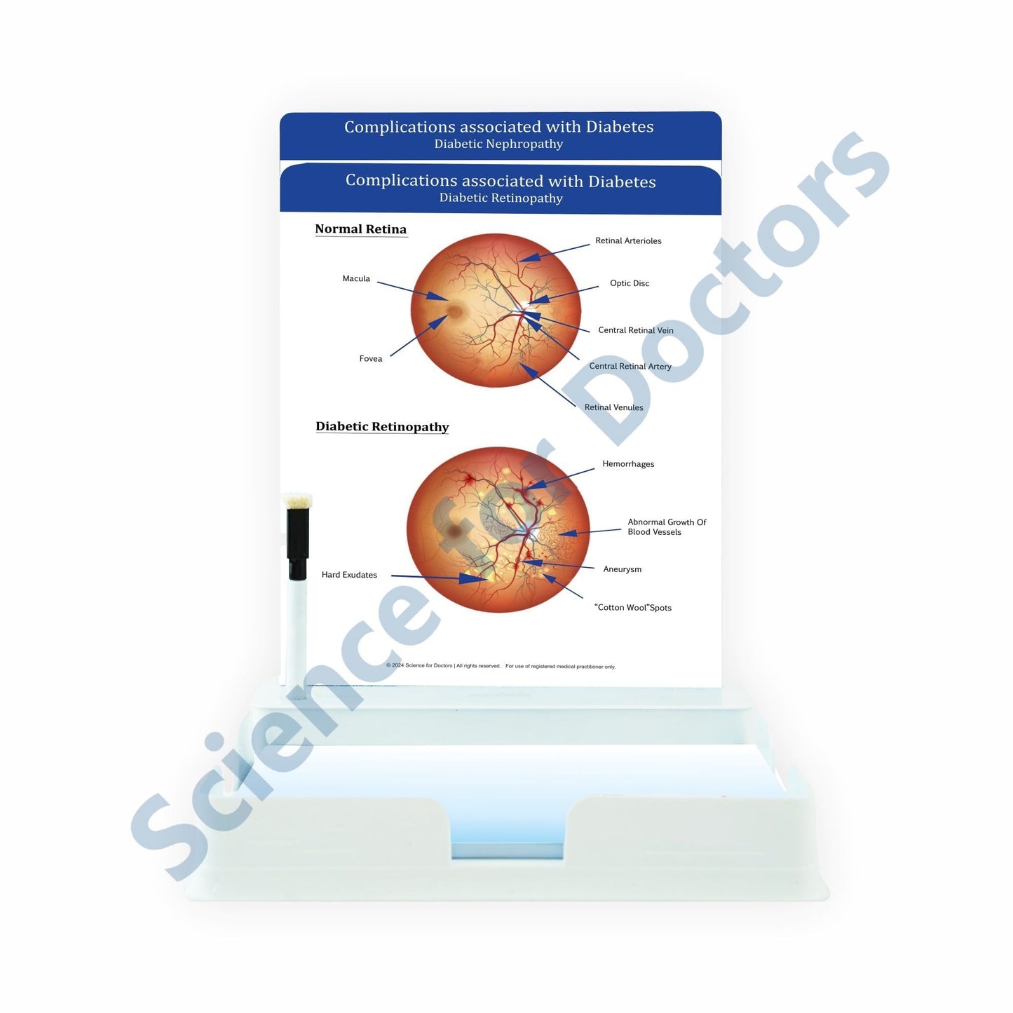 Complications associated with Diabetes: 2 Slides Patient Leaflet Tray