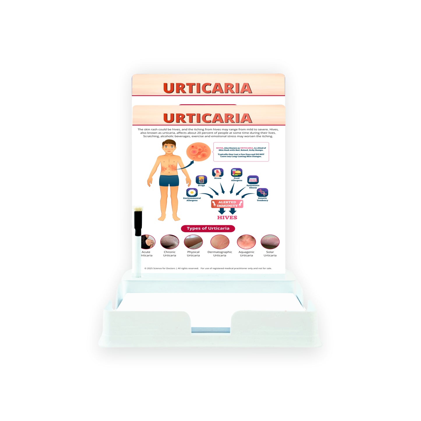 Urticaria: 2 Slides With Tray