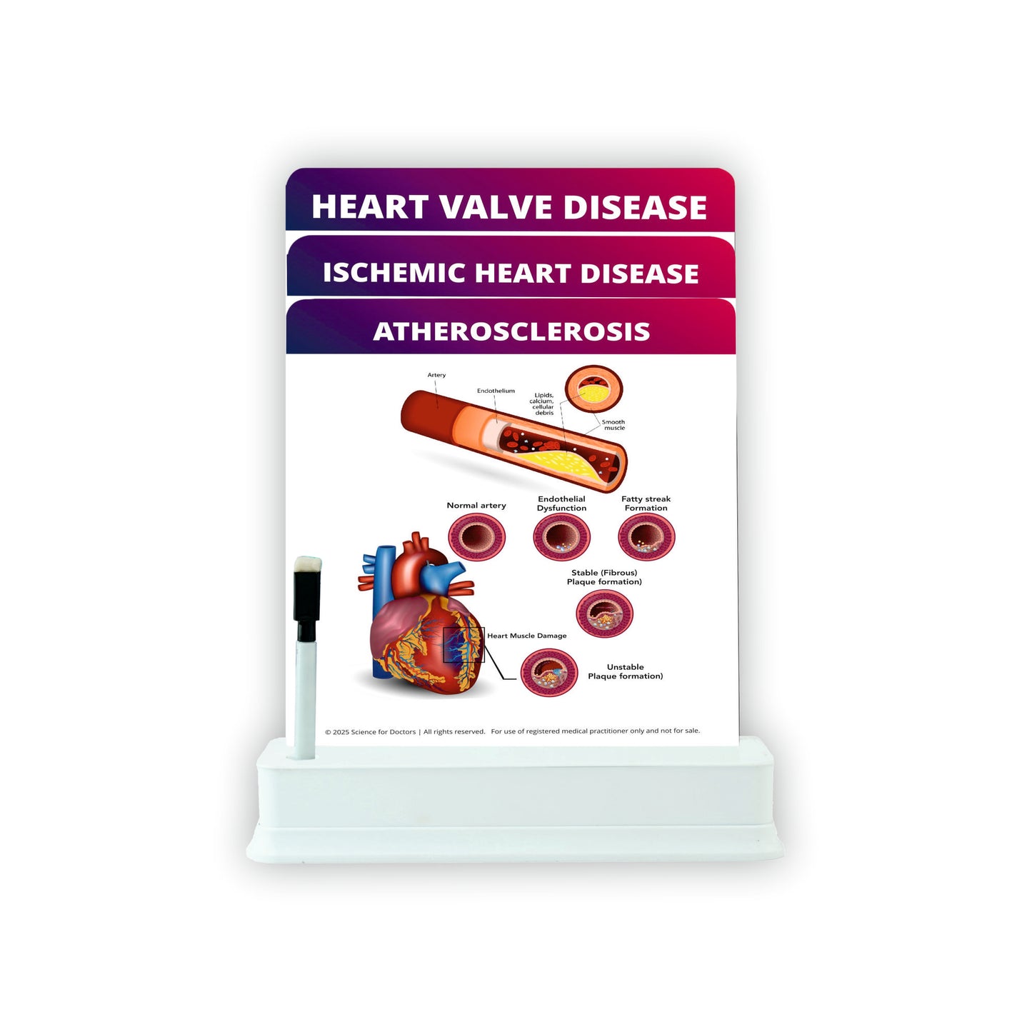 Atherosclerosis: 3 Slides With Stand