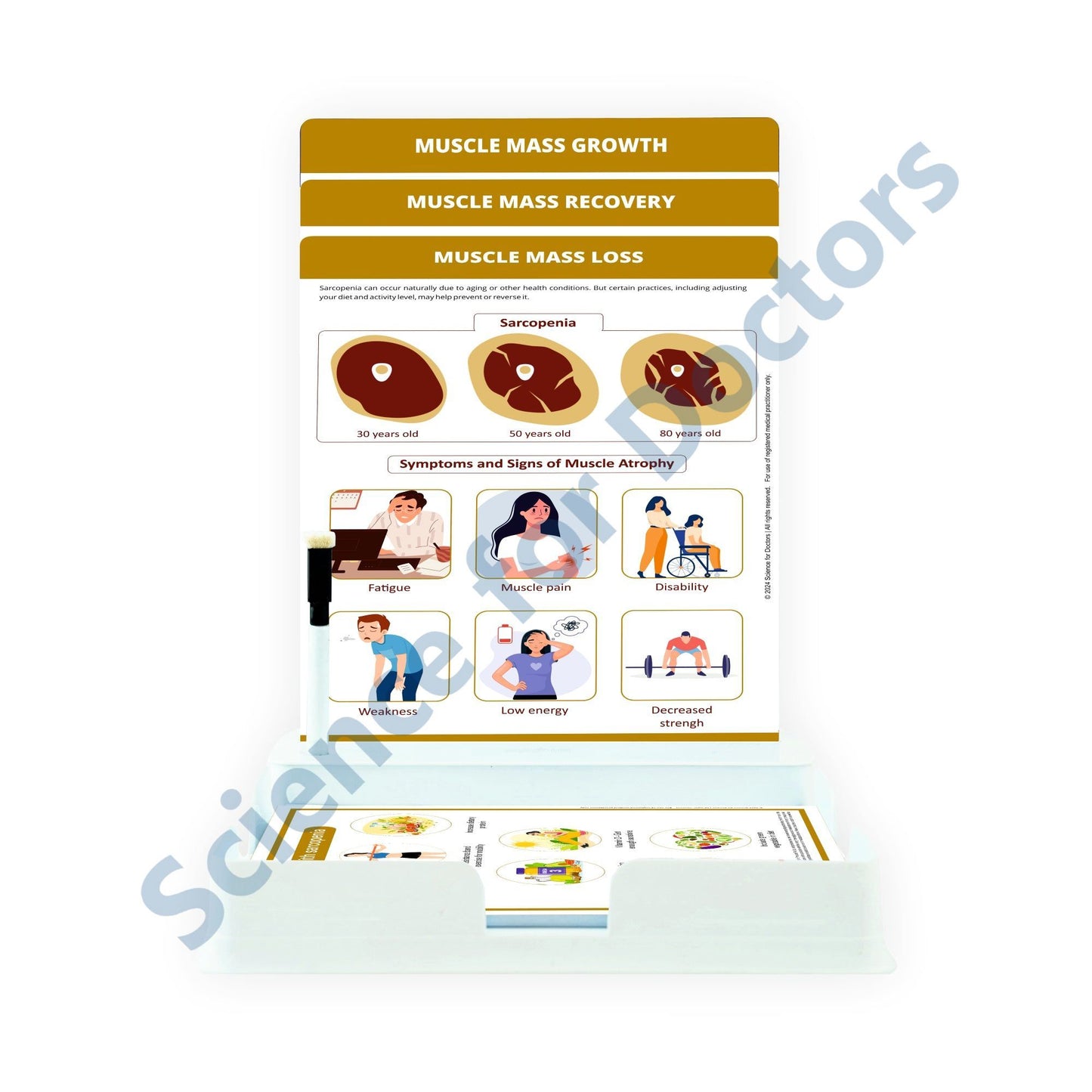 Muscle Mass Loss: 3 Slides Patient Leaflet Tray