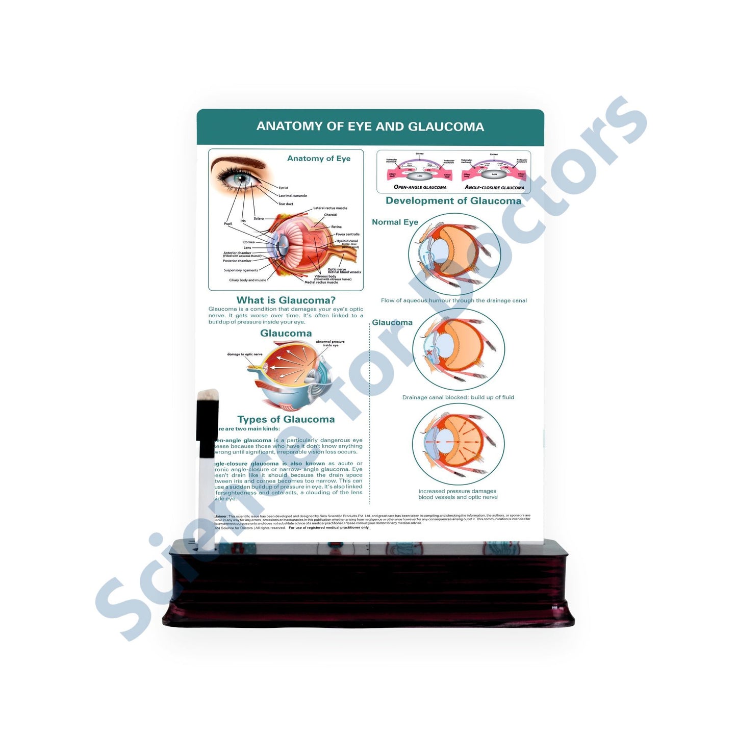 Anatomy of Eye and Glaucoma  - 1 Slide With Stand