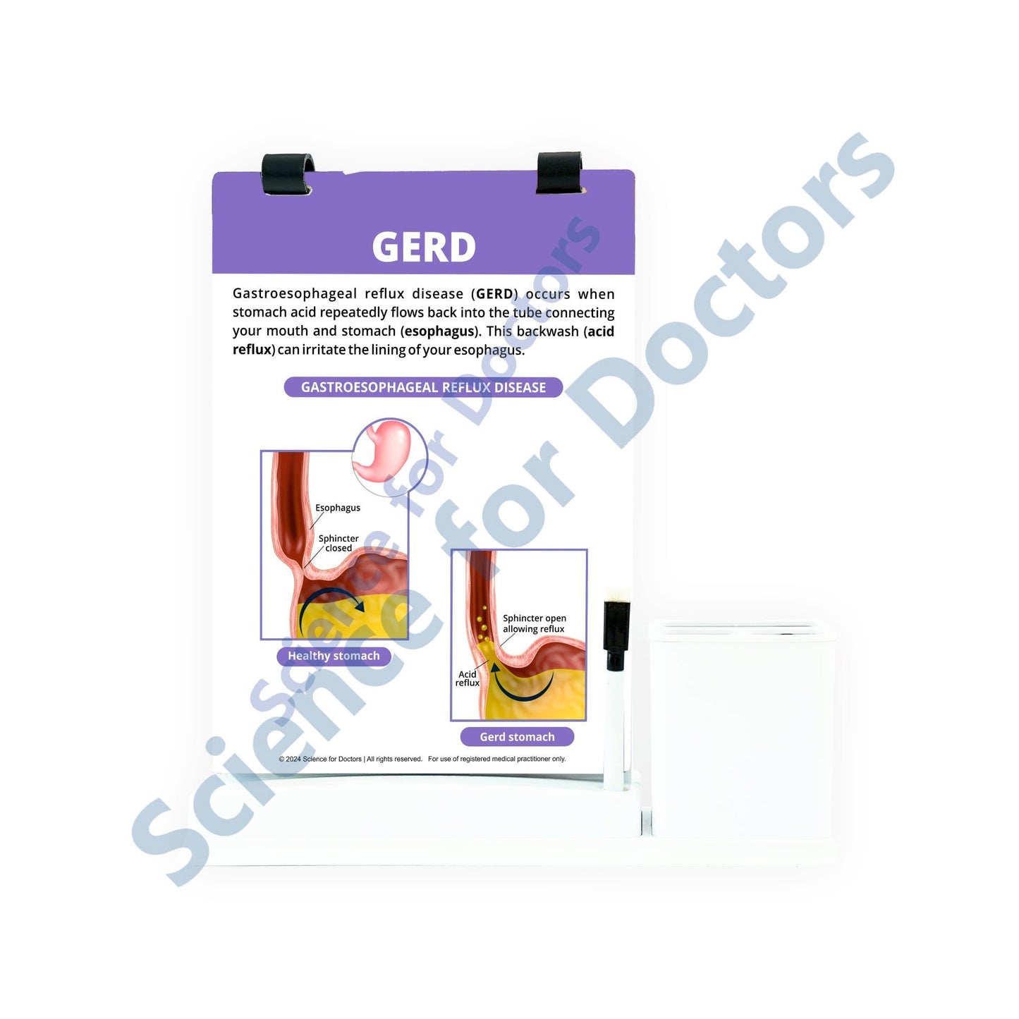 GERD: A4 Flip Wipe With Stationery Stand