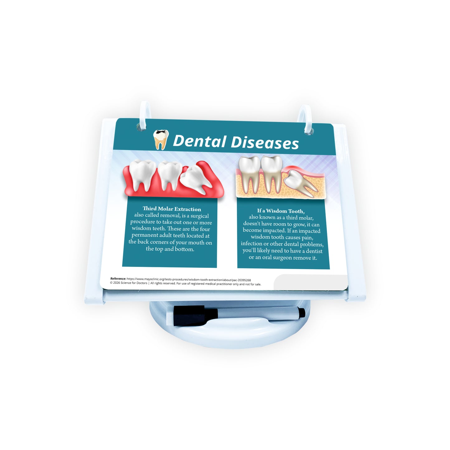 ROTRI - H WITH FLIP WIPES ON TOPS  - Dental Diseases