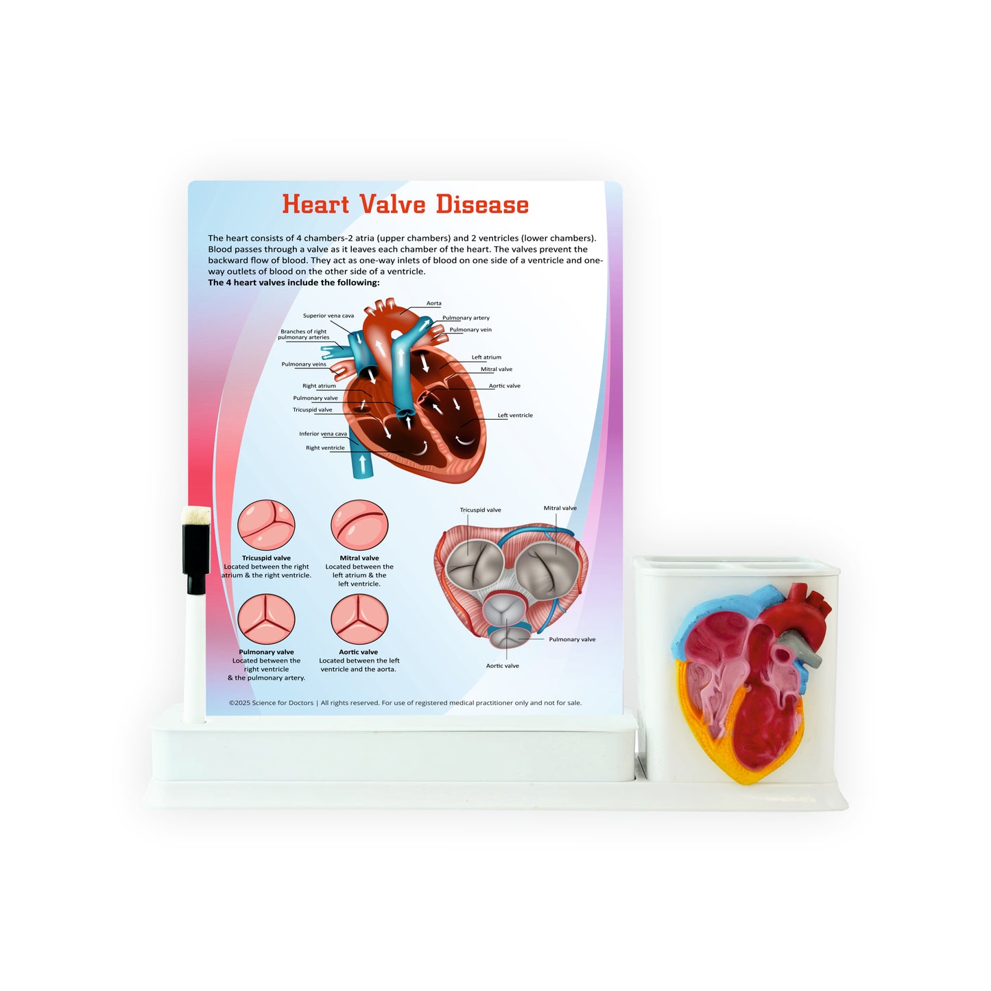 Heart Valve Disease: 1 Slide Write & Wipe With Anatomical model on Stationary Stand