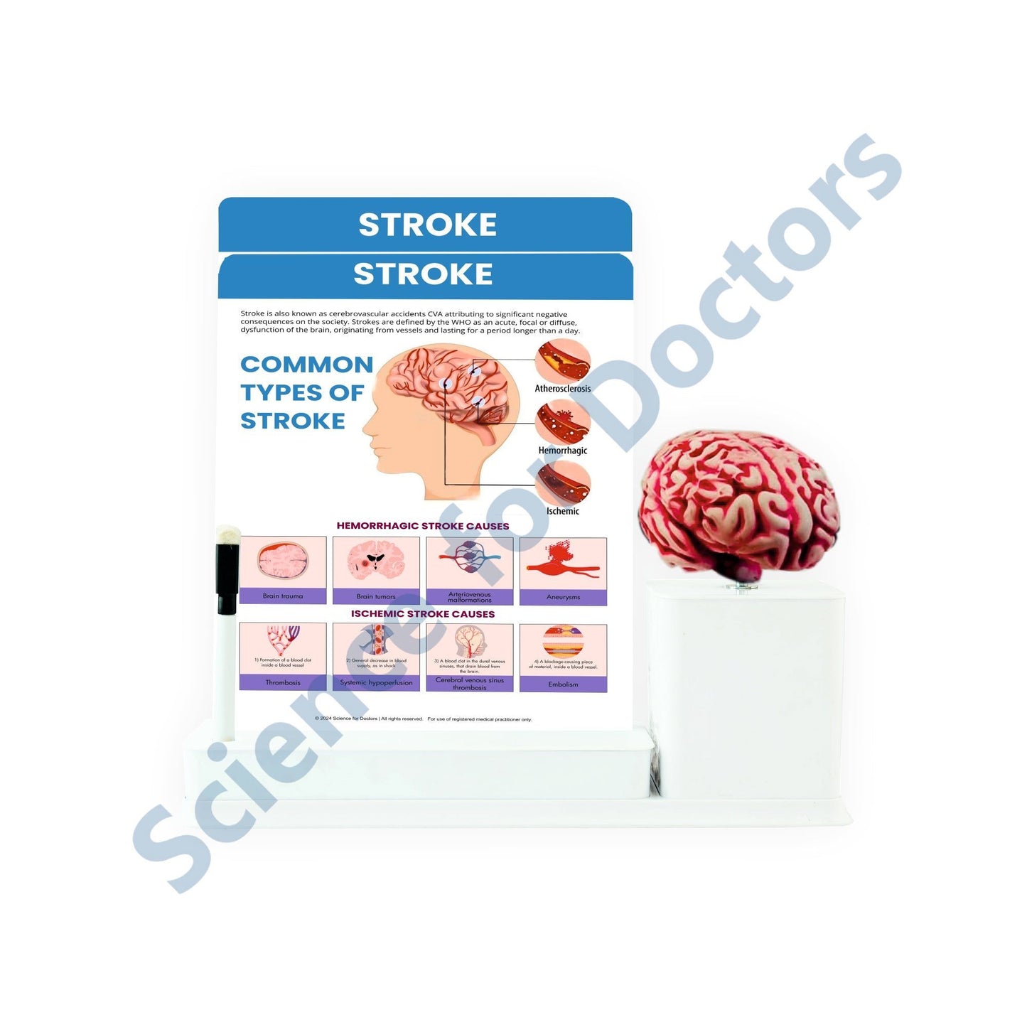 Stroke: 2 Slides Write and Wipe with Anatomical Model On Stand