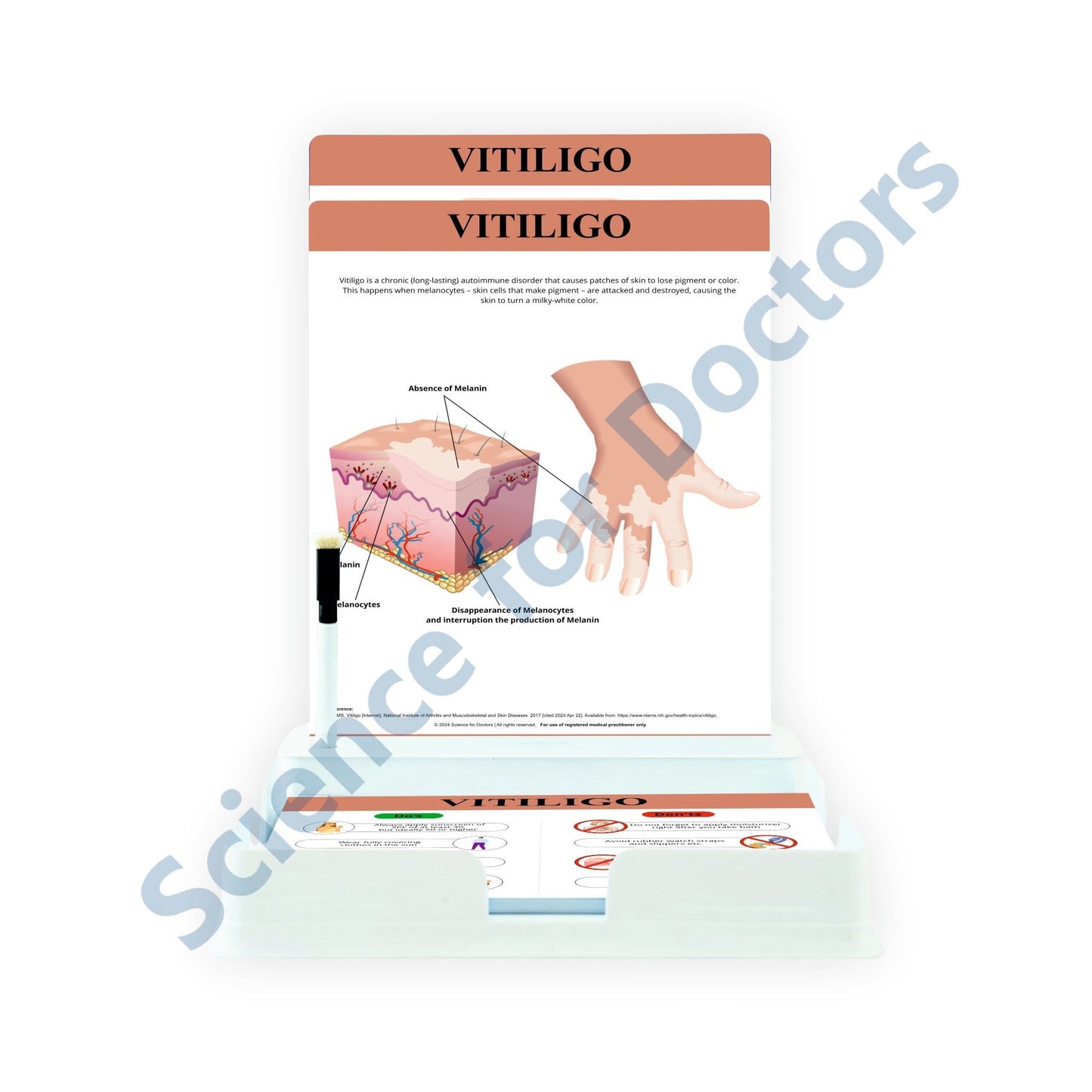 Vitiligo: 2 Slides Patient Leaflet Tray