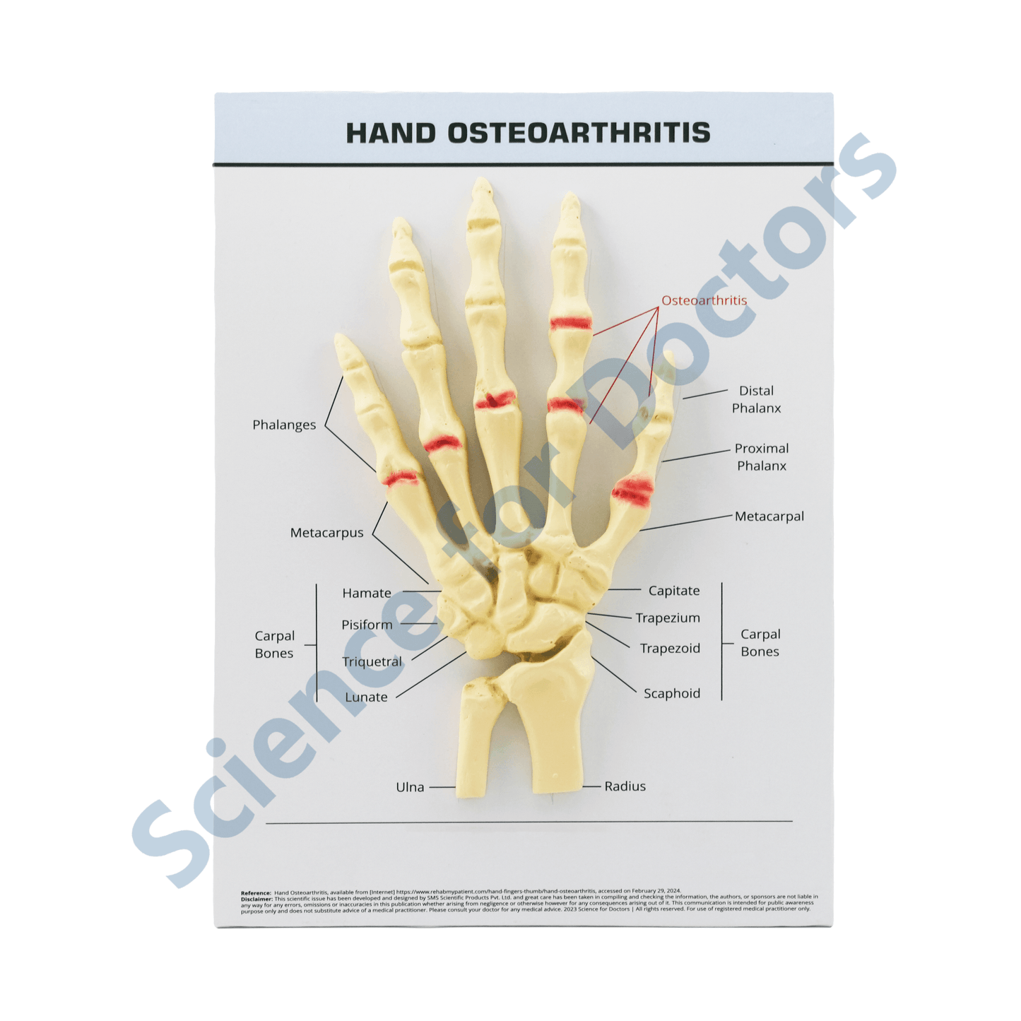 Hand Osteoarthritis: 3D therapy Board